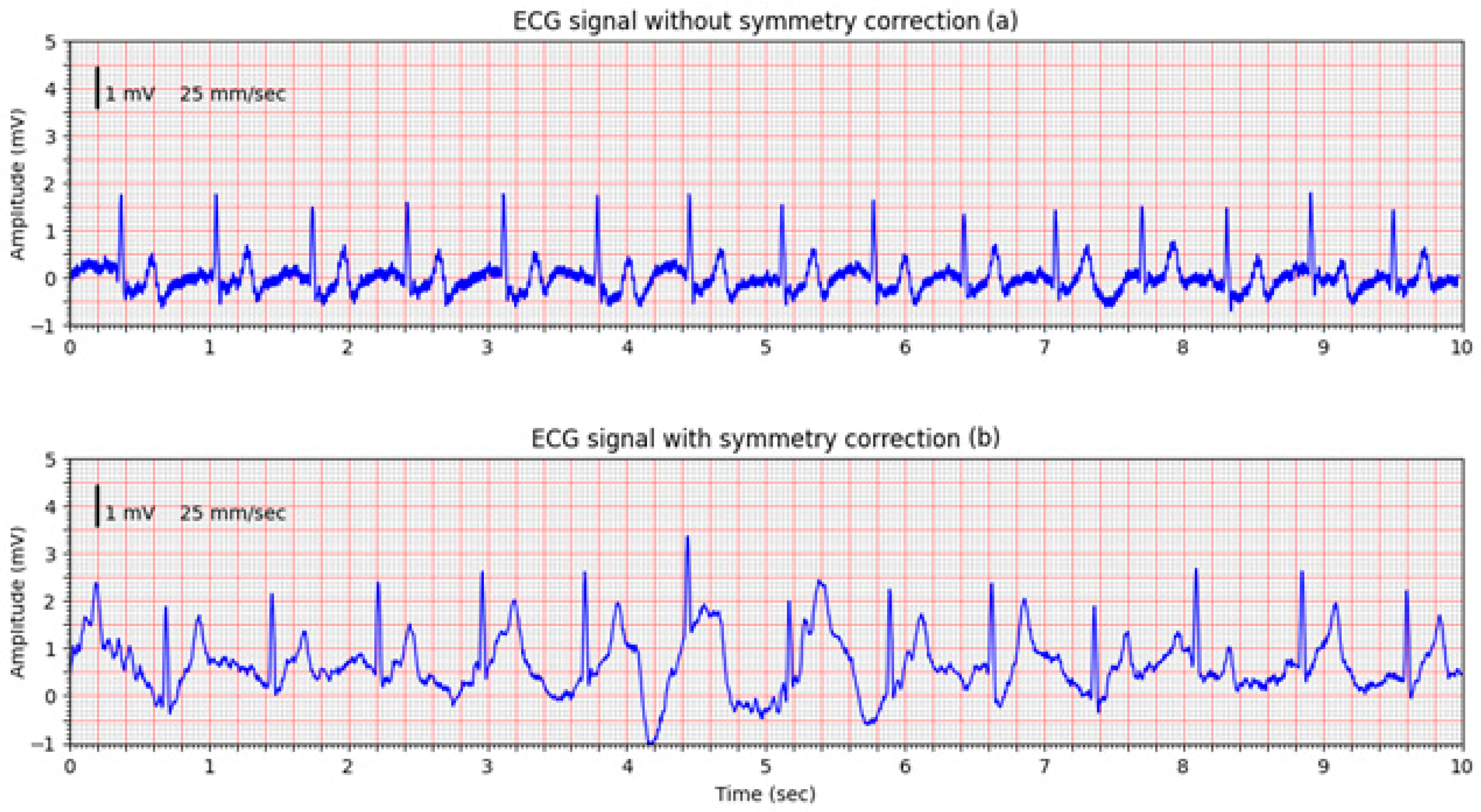 Sensors 25 05856 g012