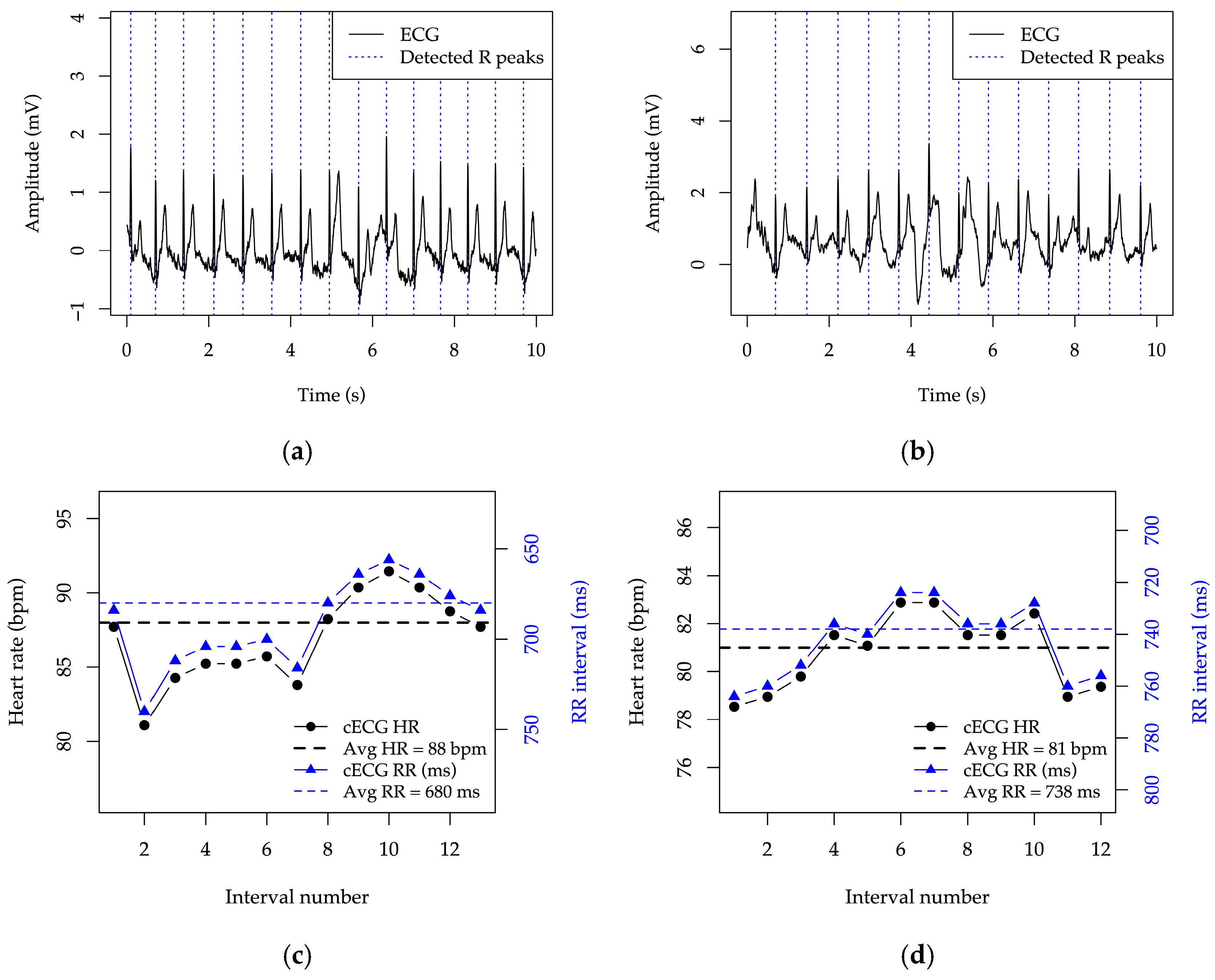 Sensors 25 05856 g014