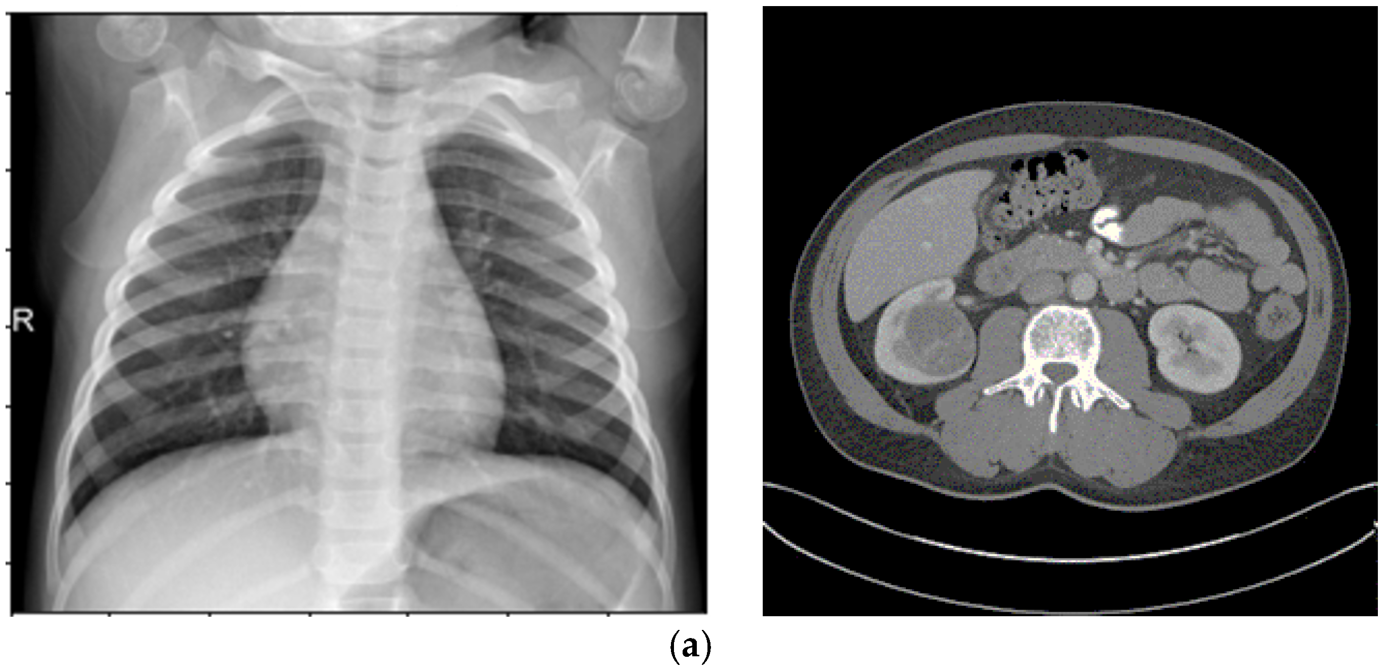 Sensors 25 05931 g003a