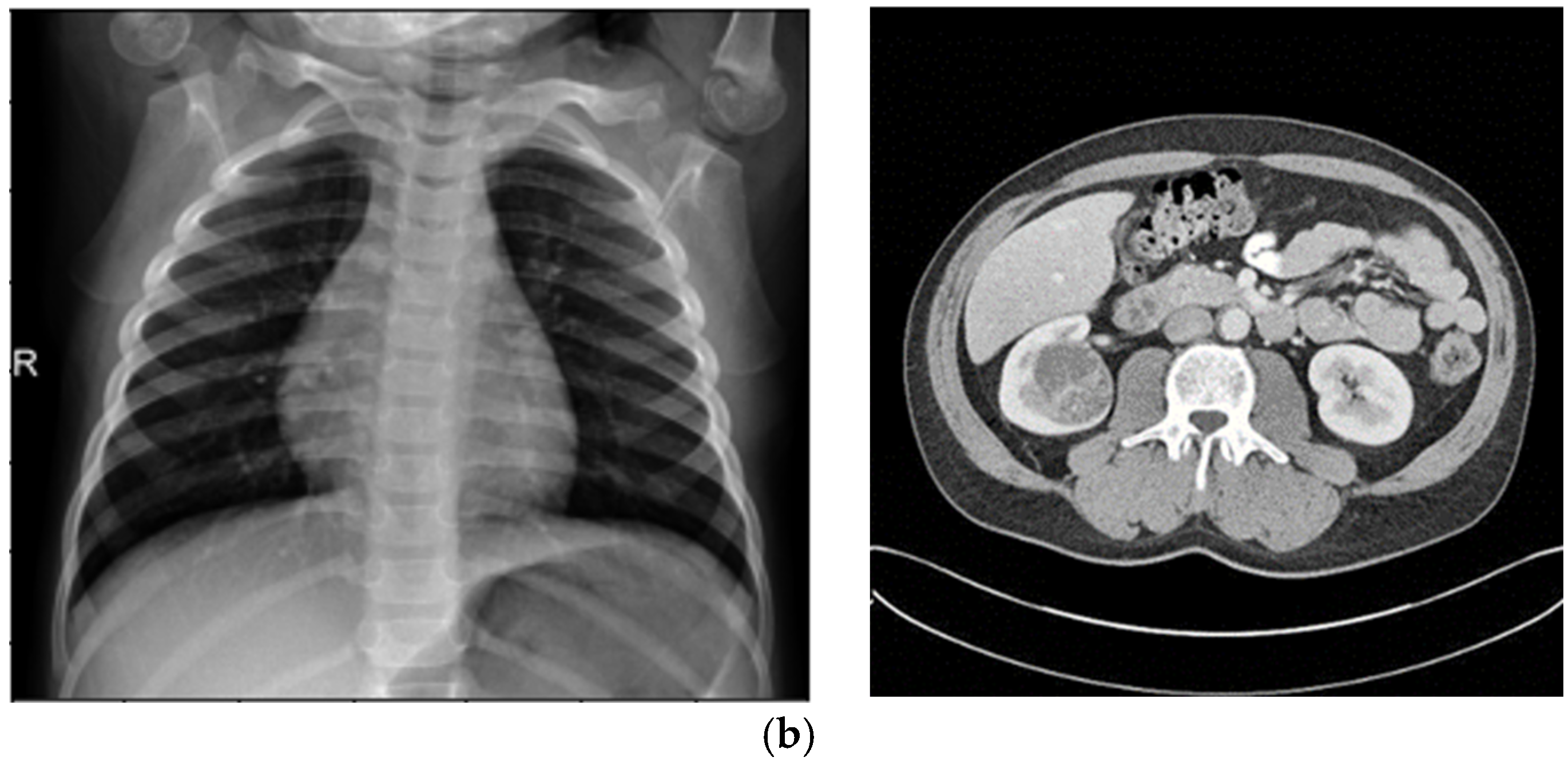 Sensors 25 05931 g003b