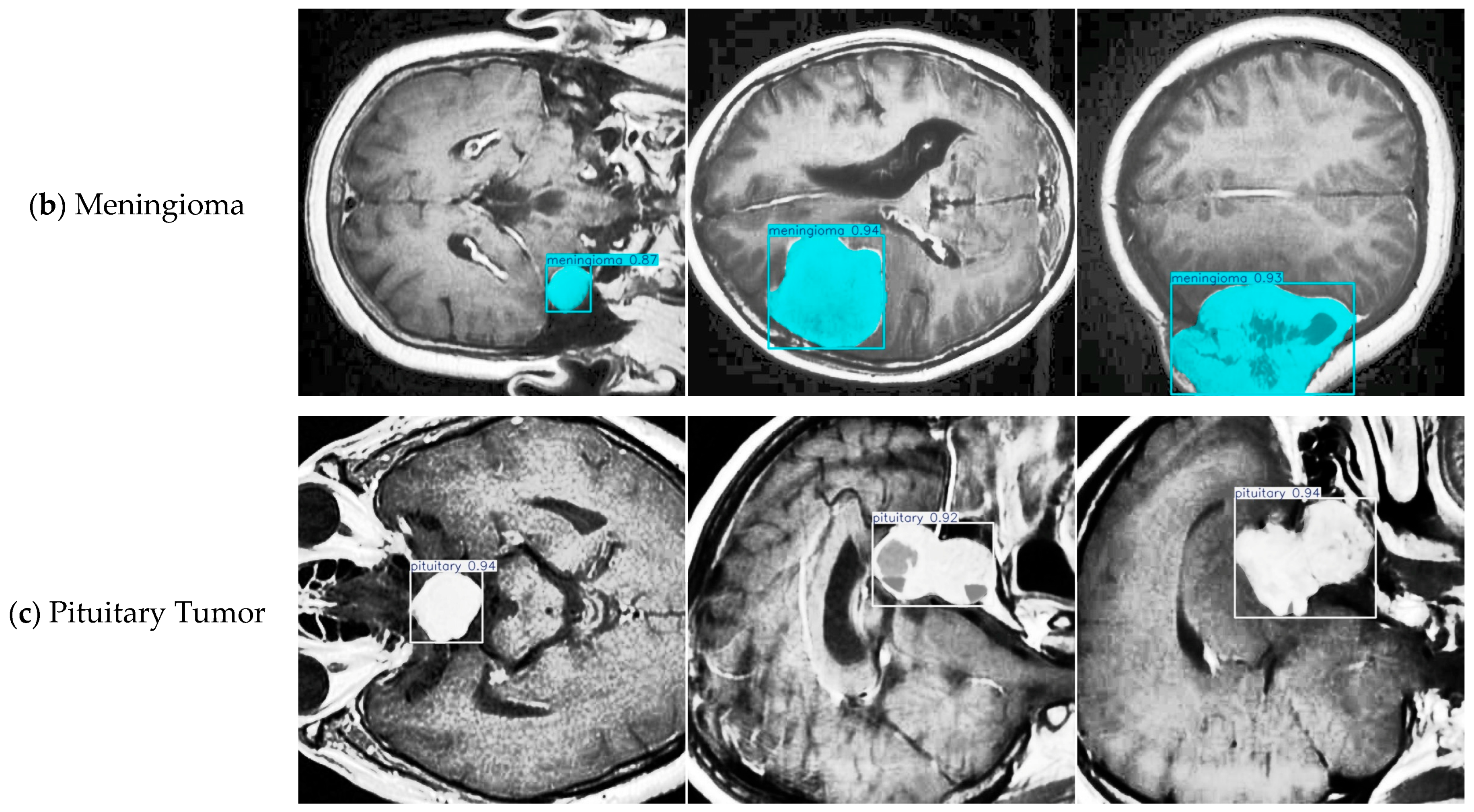 Sensors 25 05993 g011b Sensors 25 05993 g011b