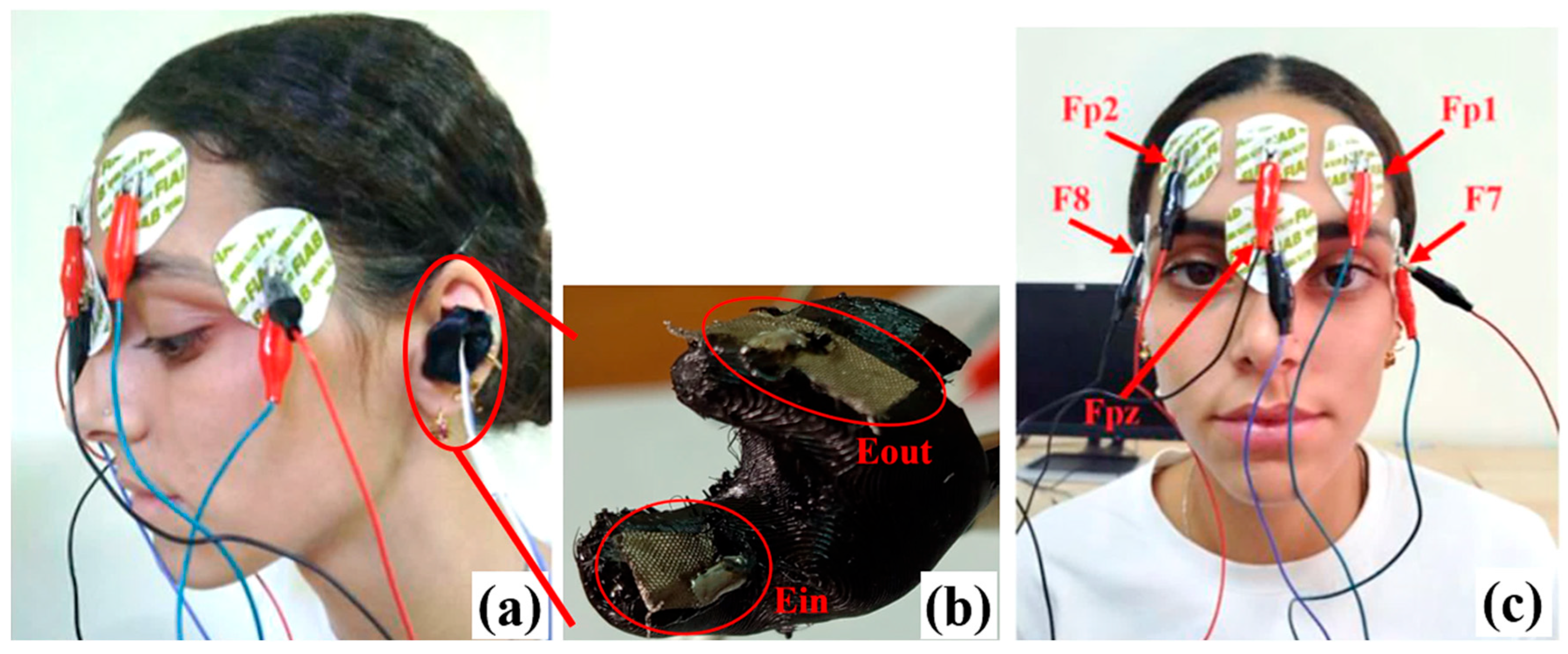 Sensors 25 06021 g001 Sensors 25 06021 g001