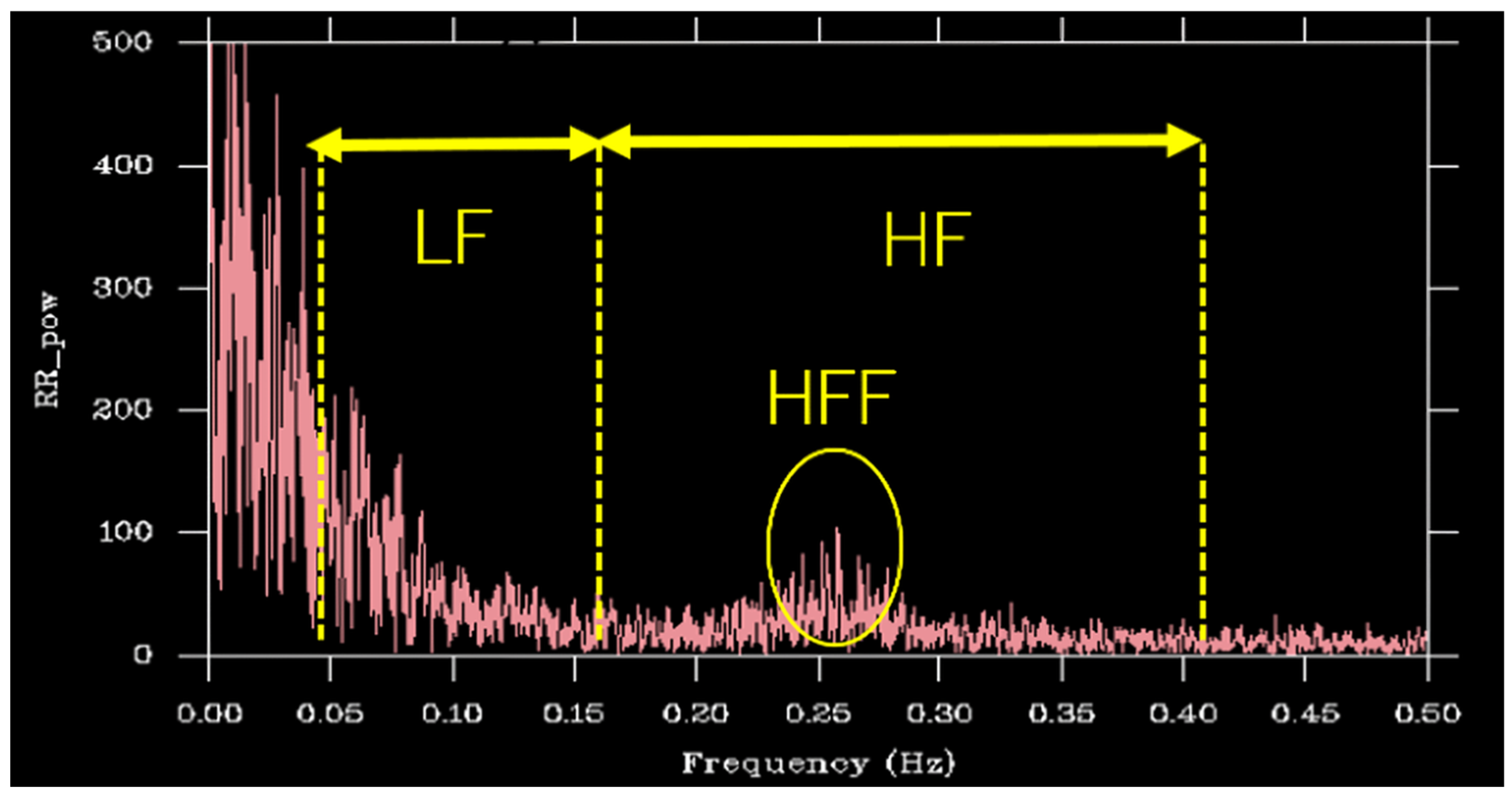Sensors 25 06039 g003 Sensors 25 06039 g003