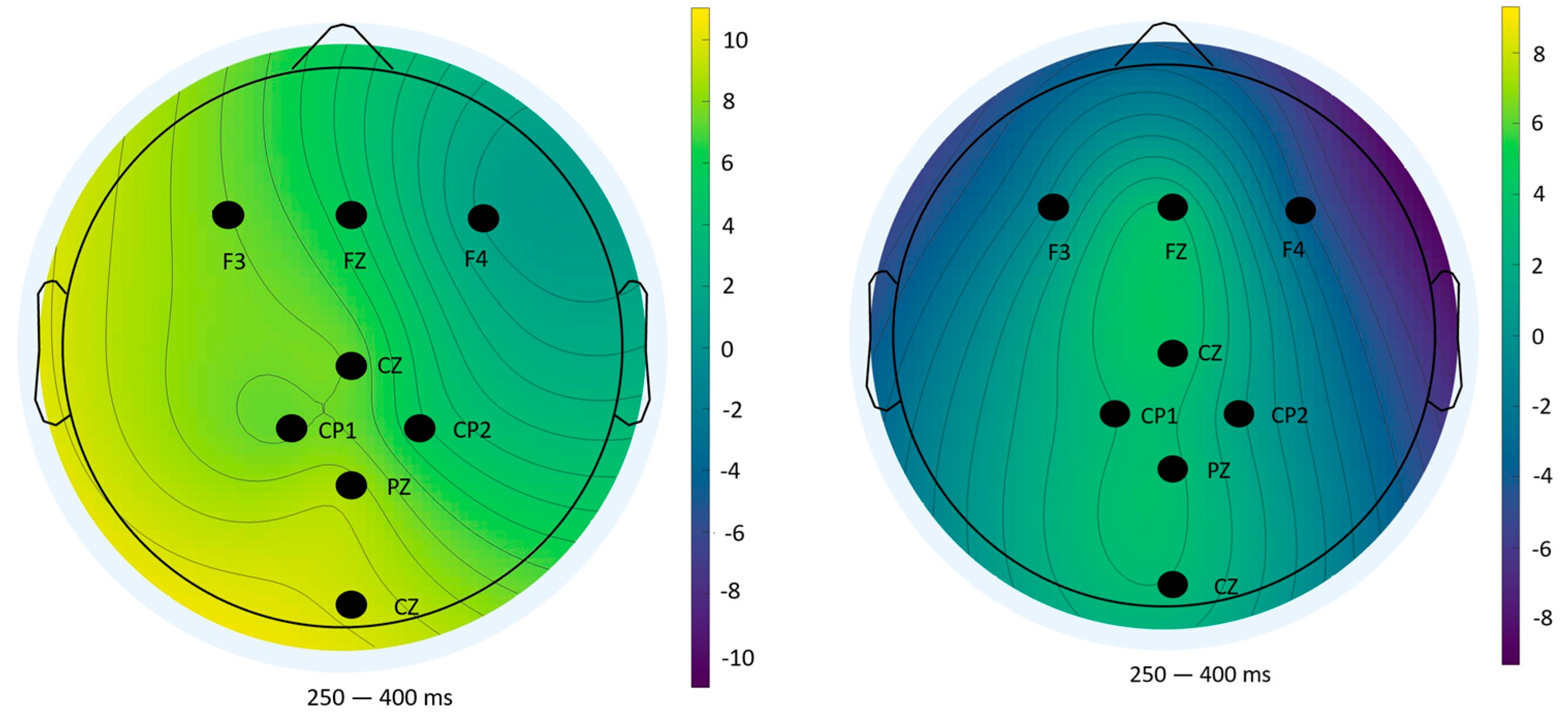 Sensors 25 06201 g013