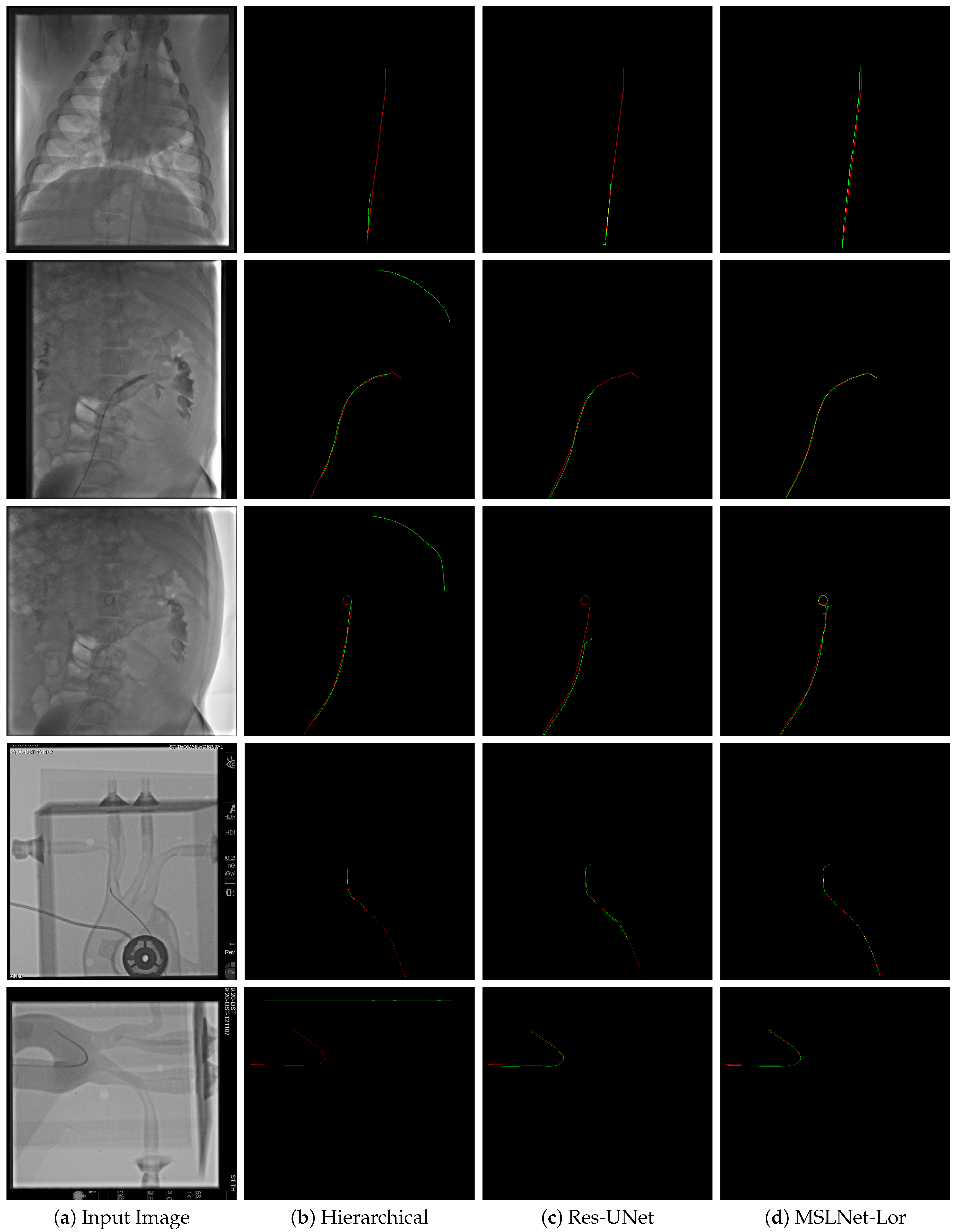 Sensors 25 06426 g0a4