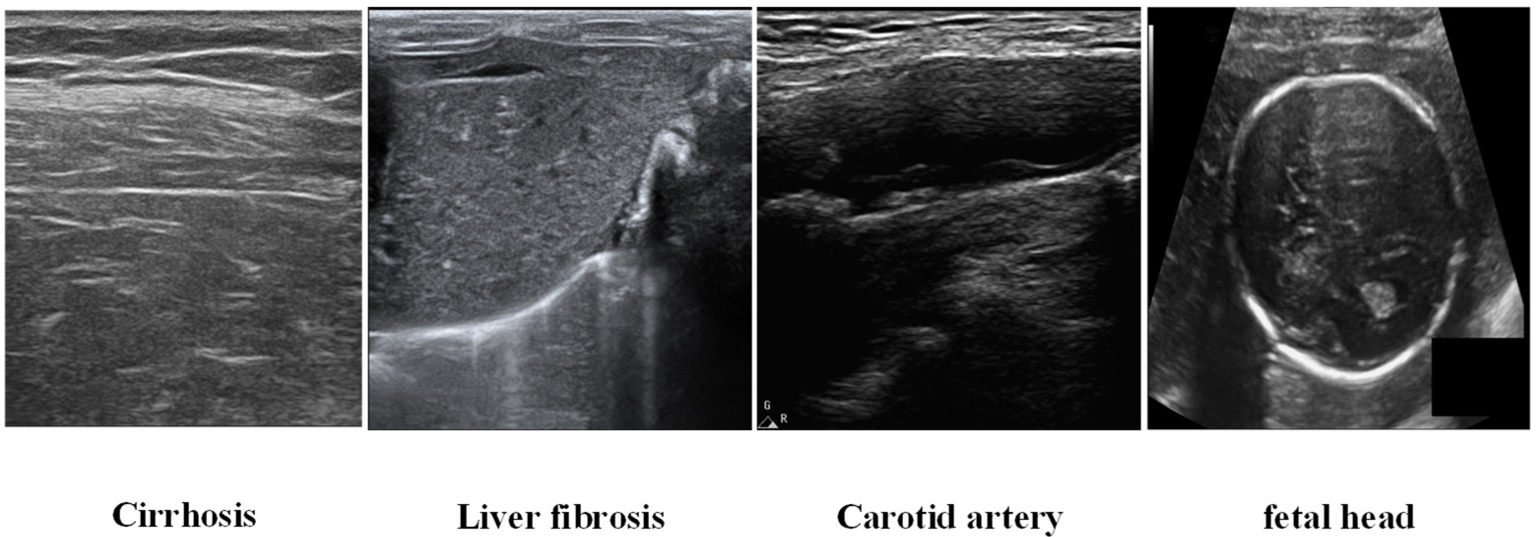 Sensors 25 06694 g004 Sensors 25 06694 g004