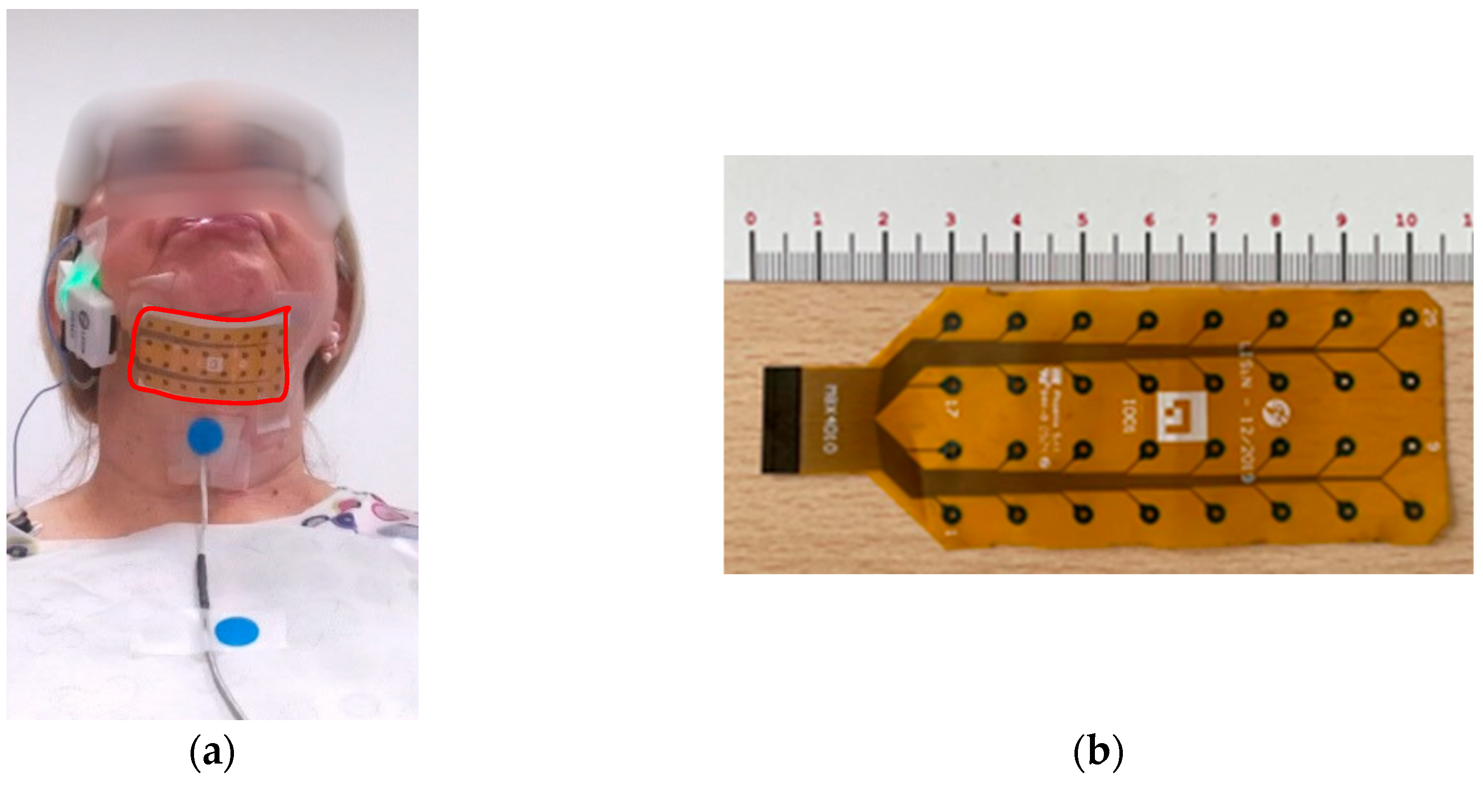 Sensors 25 06834 g001 Sensors 25 06834 g001