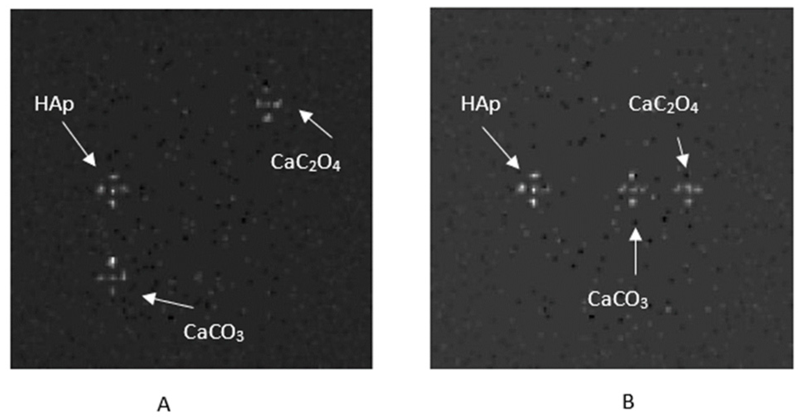 Sensors 25 06853 g006