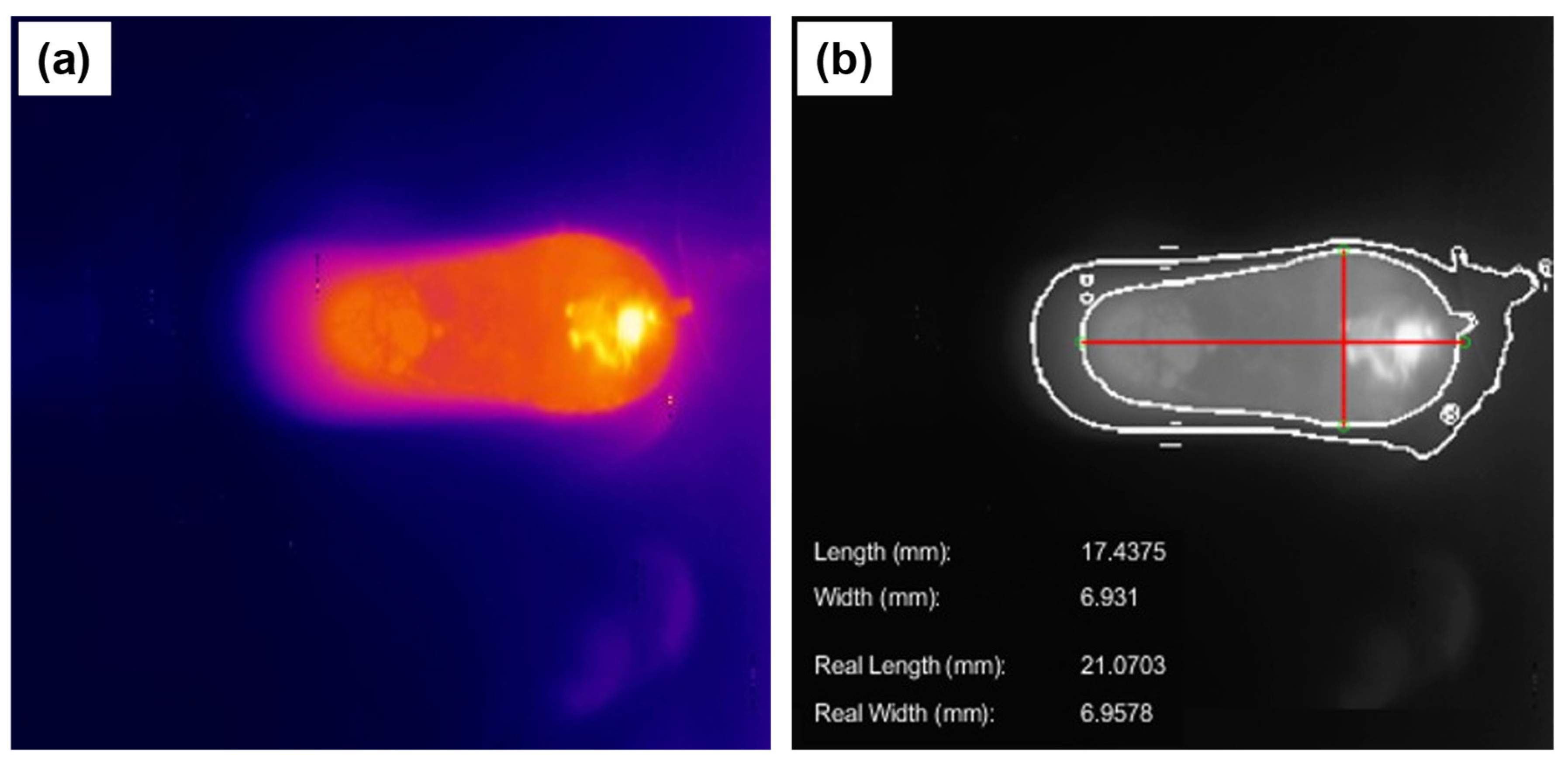 Sensors 25 06858 g012
