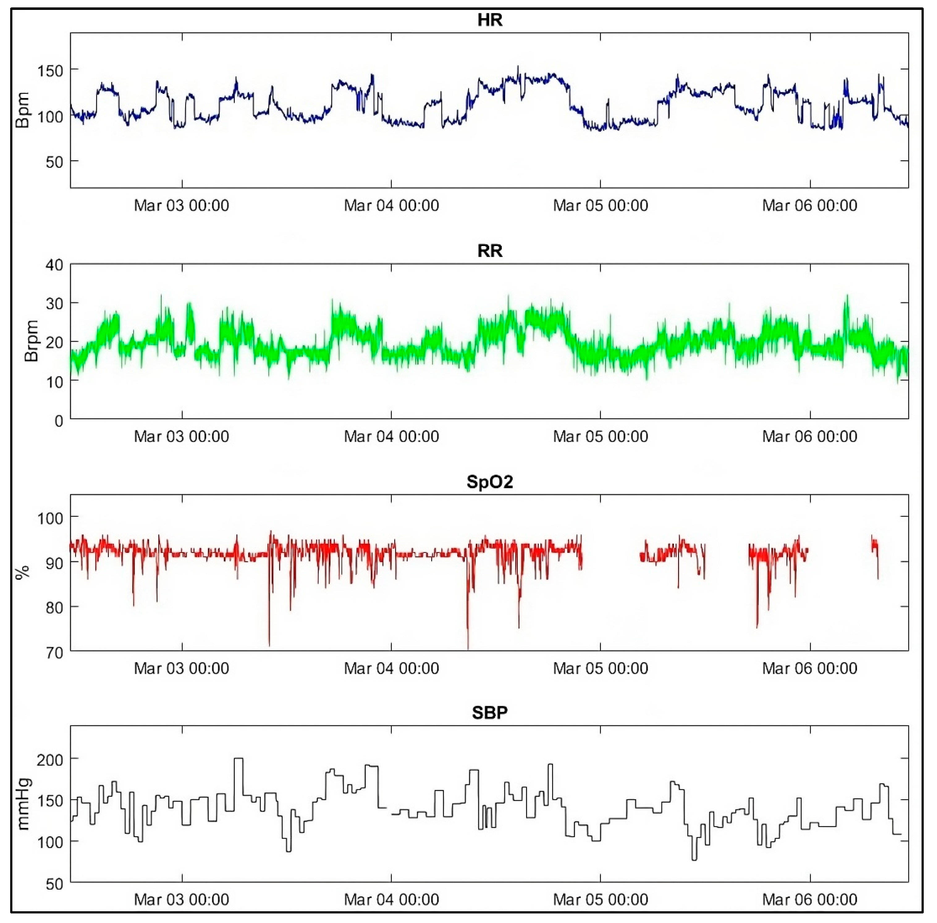 Sensors 25 06970 g003 Sensors 25 06970 g003