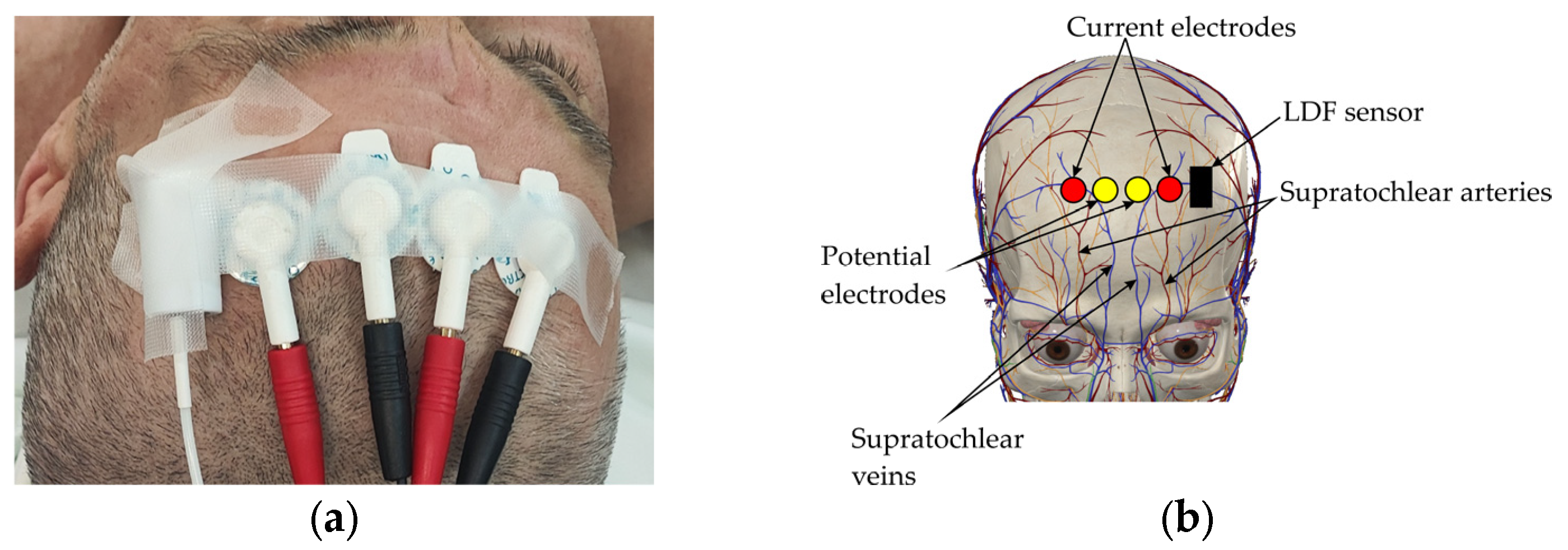 Sensors 25 07190 g001 Sensors 25 07190 g001