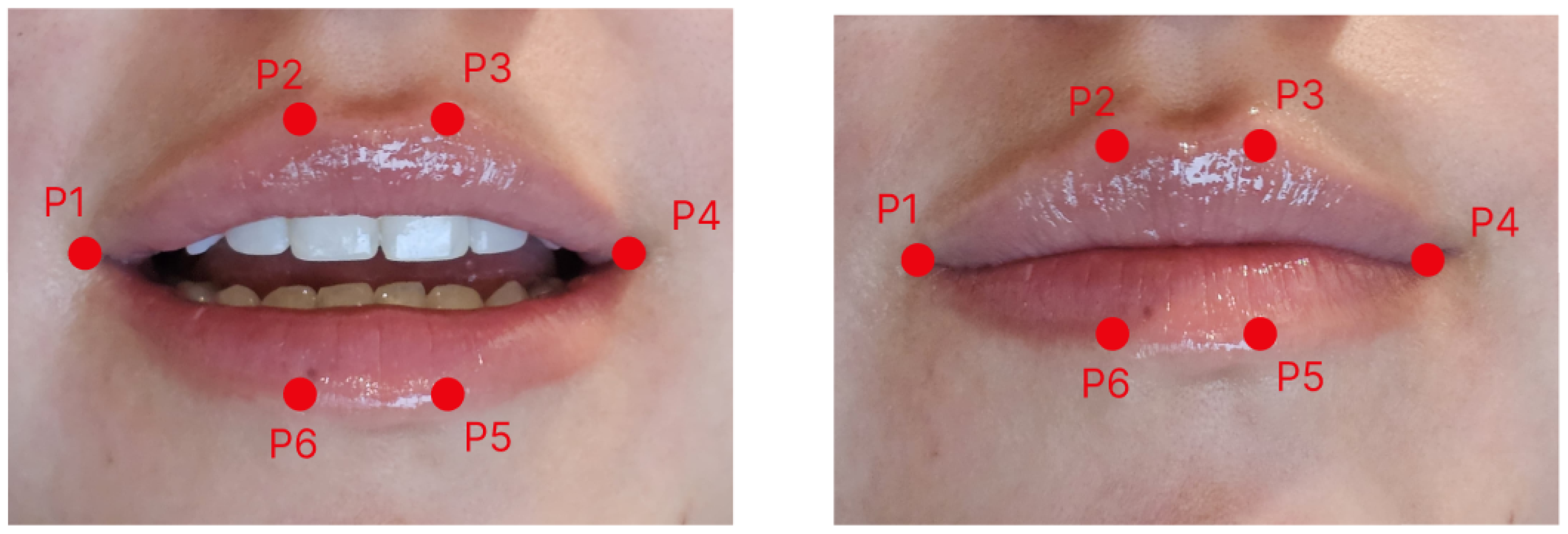 Sensors 26 00889 g004