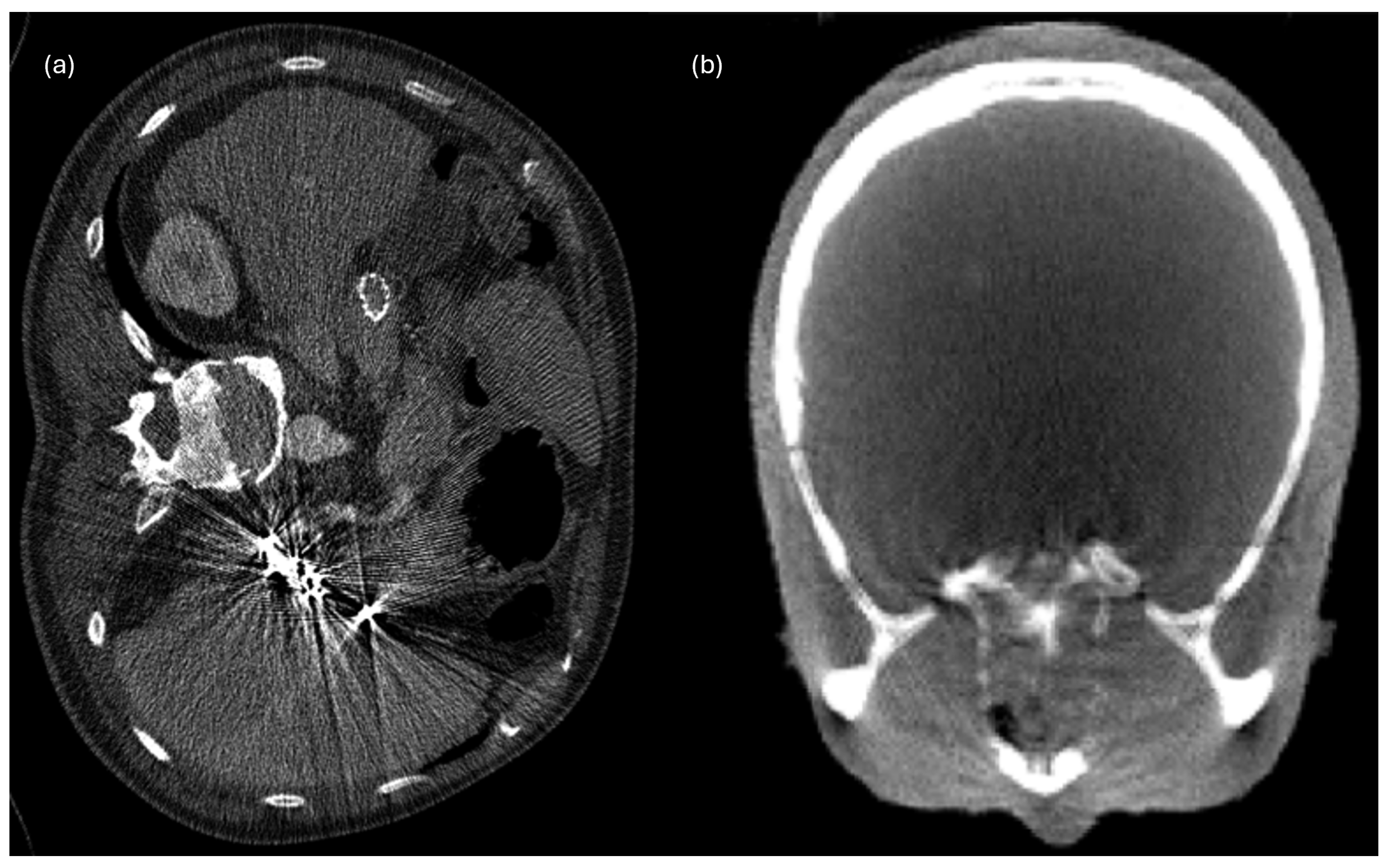 Sensors 26 01039 g005