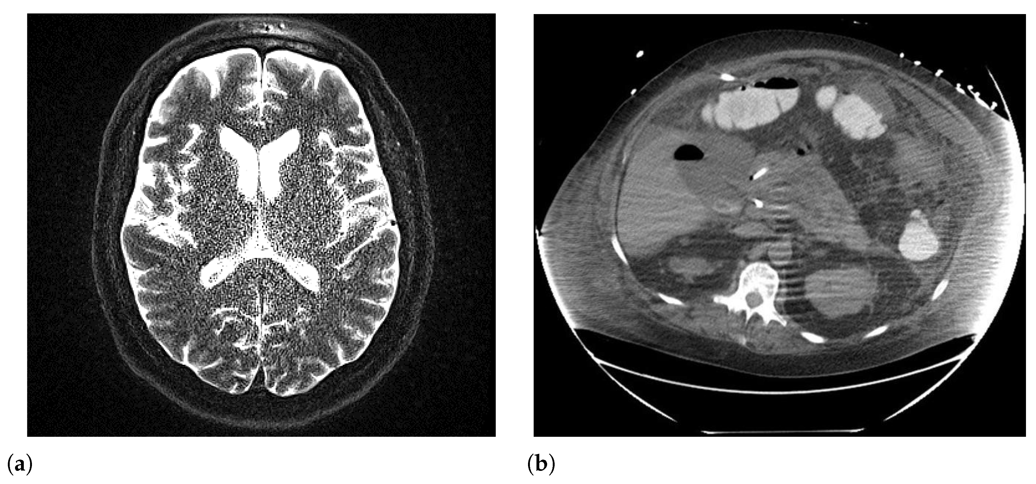 Sensors 26 01039 g006