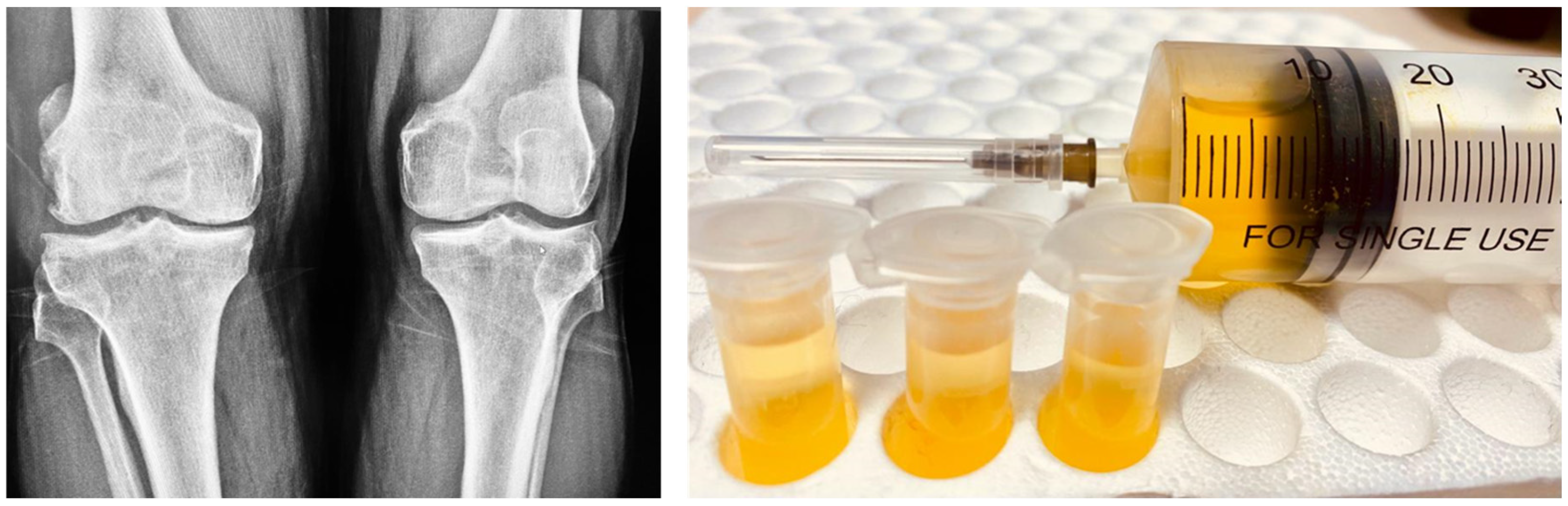 Separations 11 00262 g002 Separations 11 00262 g002