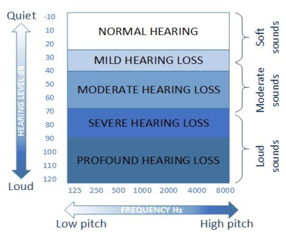 Degrees of hearing loss