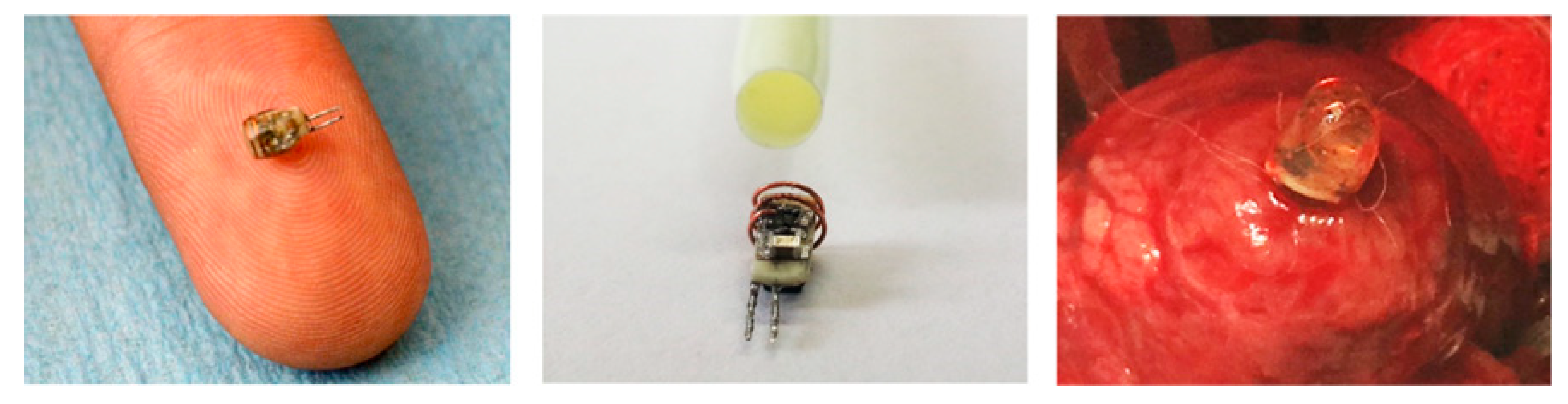 Signals 01 00012 g005 Signals 01 00012 g005