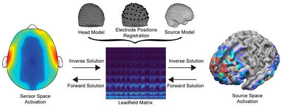 Advances in Electrical Source Imaging: A Review of the Current