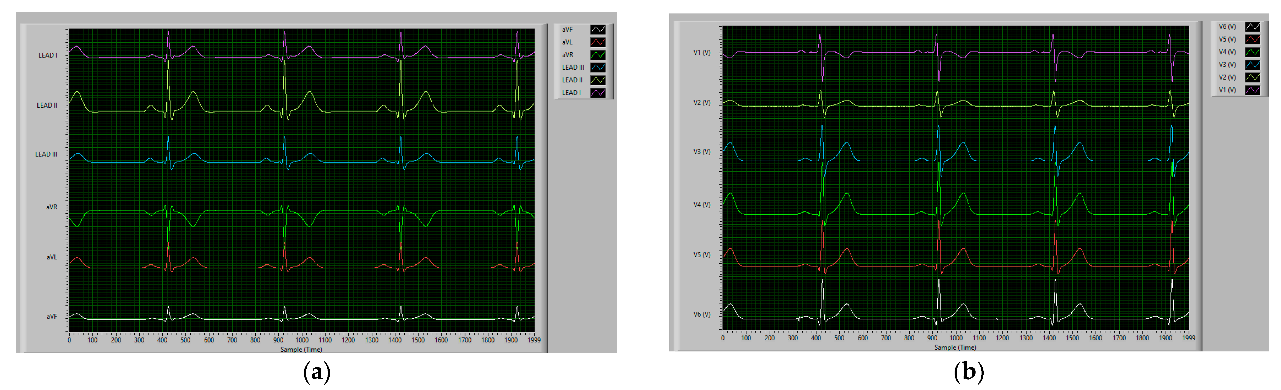Signals 03 00013 g005