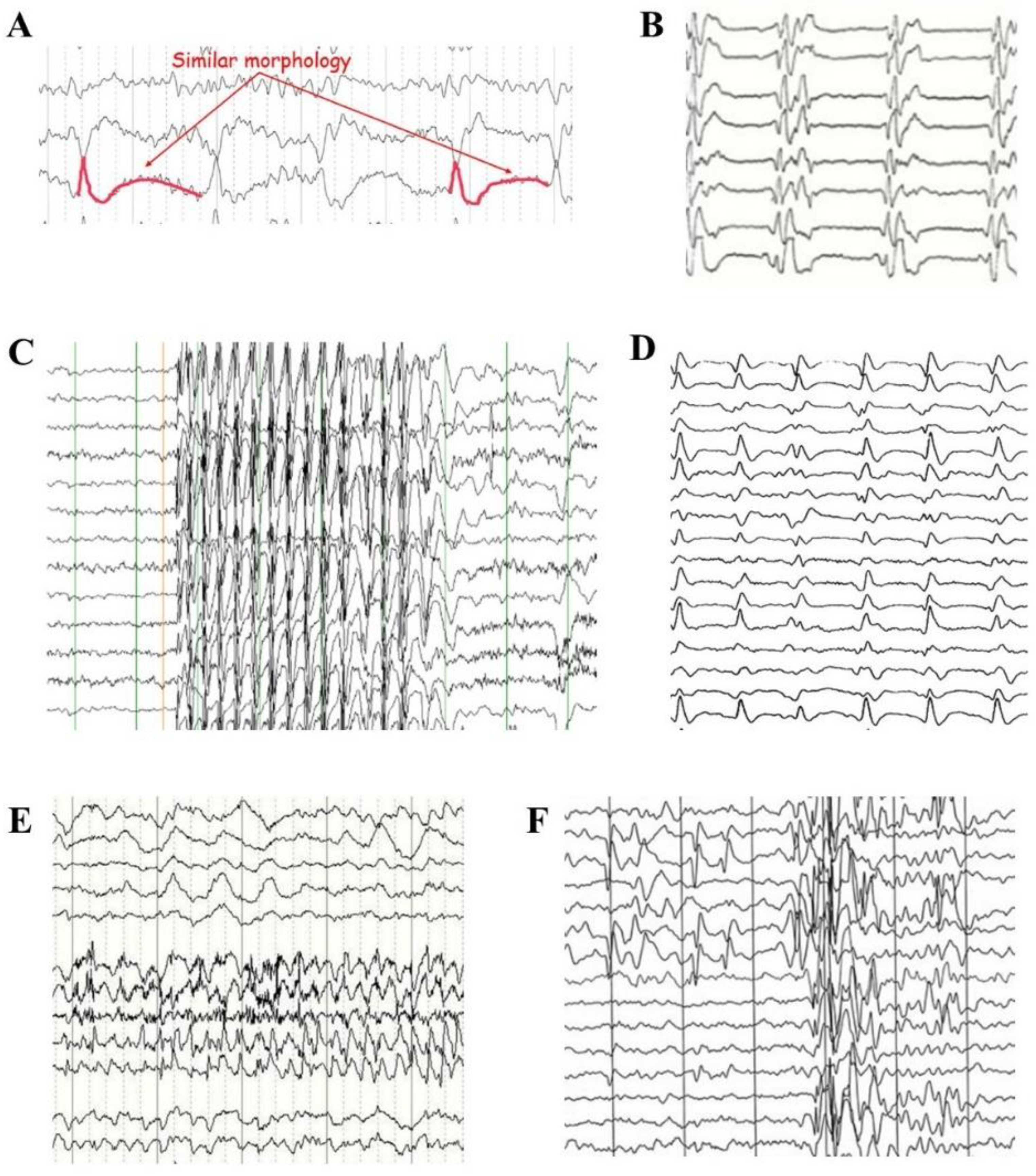Signals 05 00015 g002