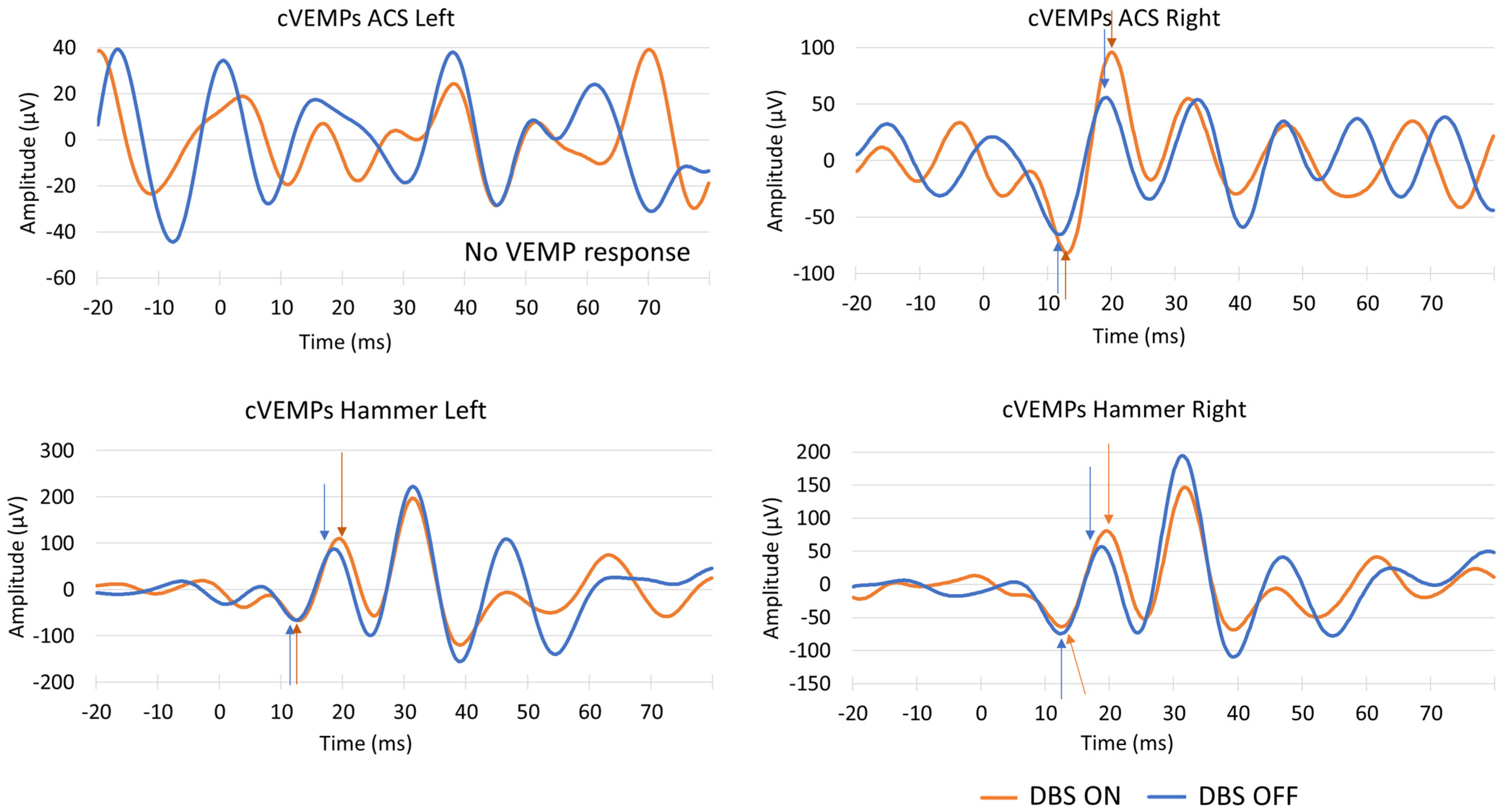Signals 06 00010 g004