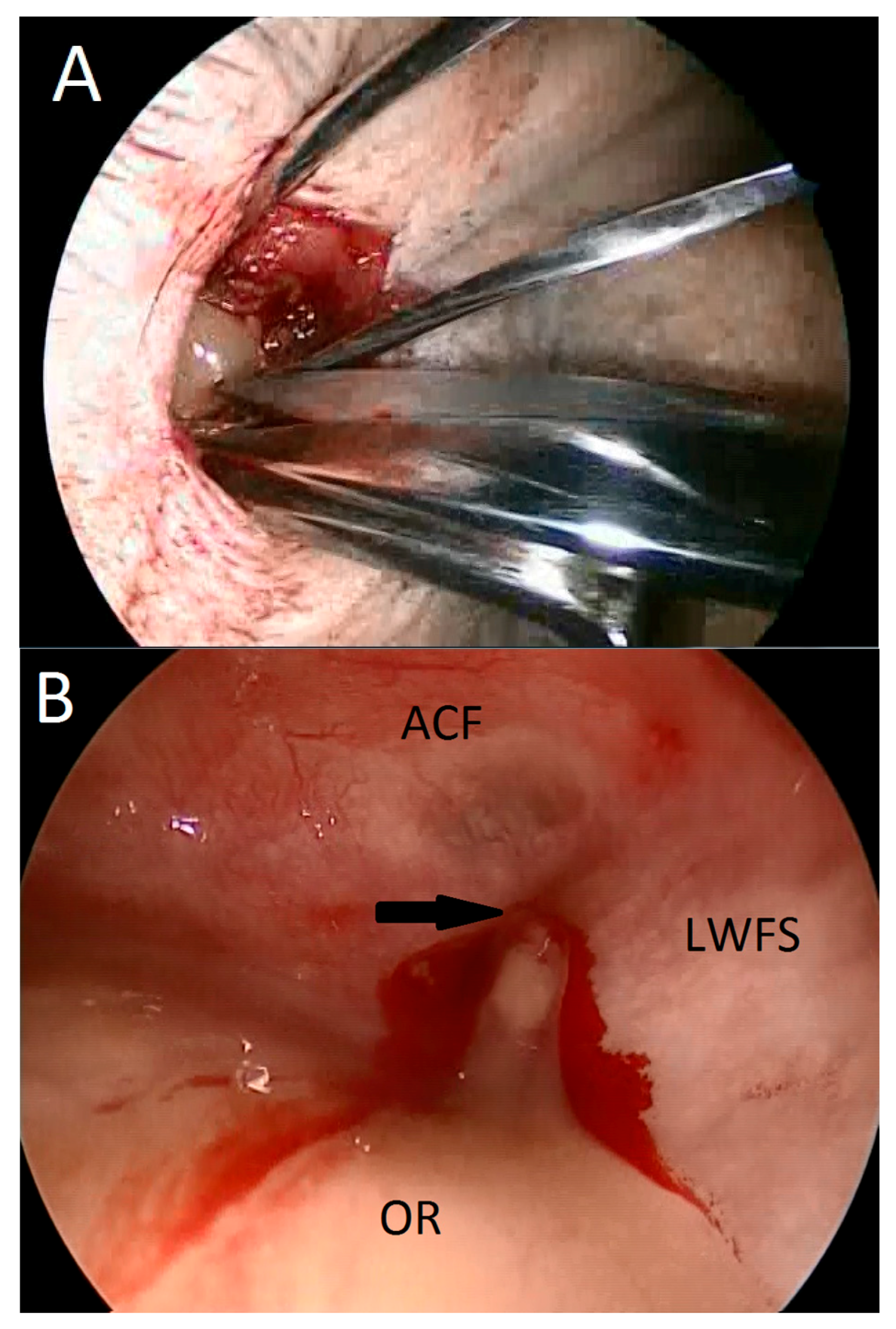 Sinusitis 01 00099 g003