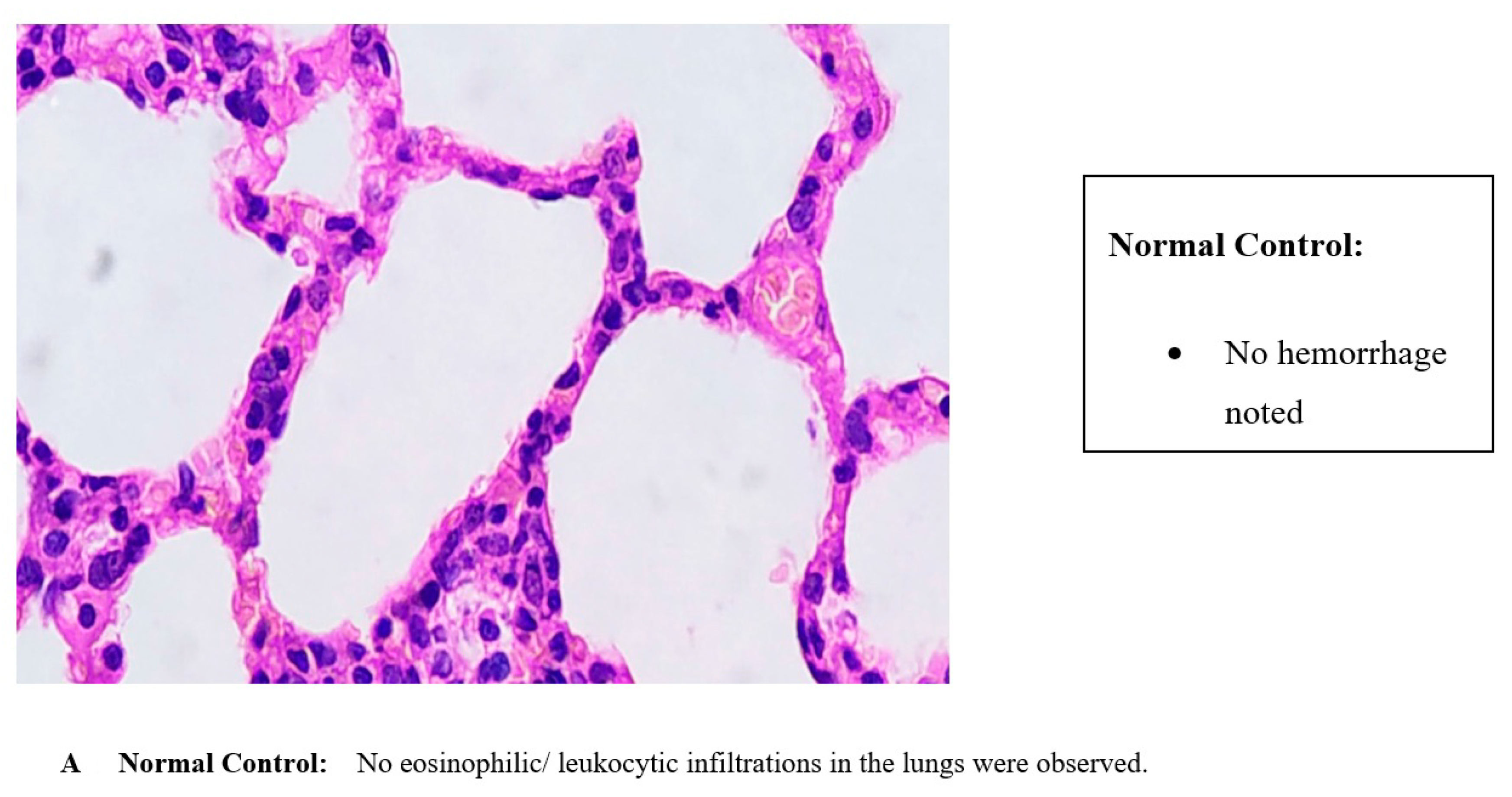 Sinusitis 05 00003 g003a