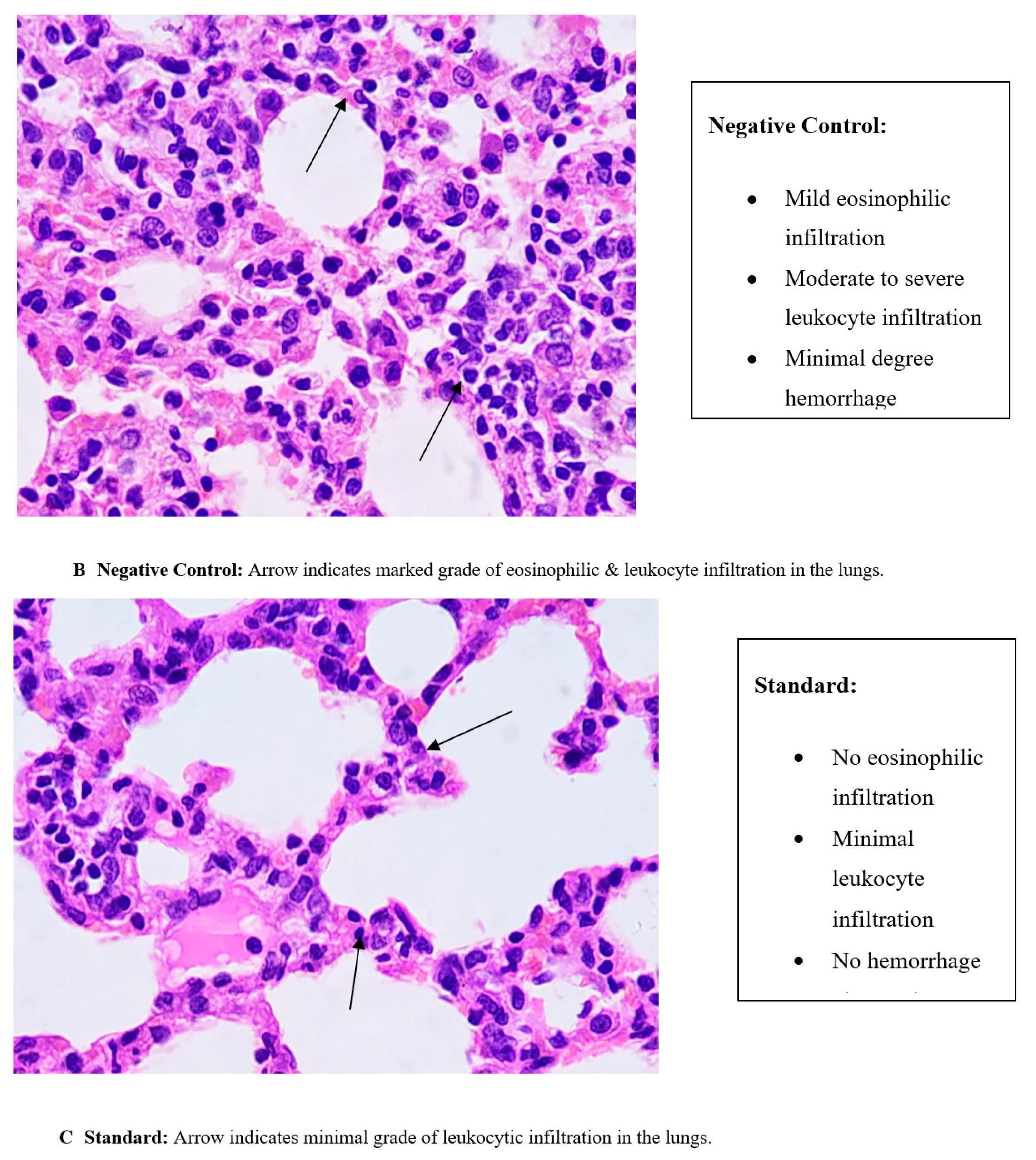 Sinusitis 05 00003 g003b