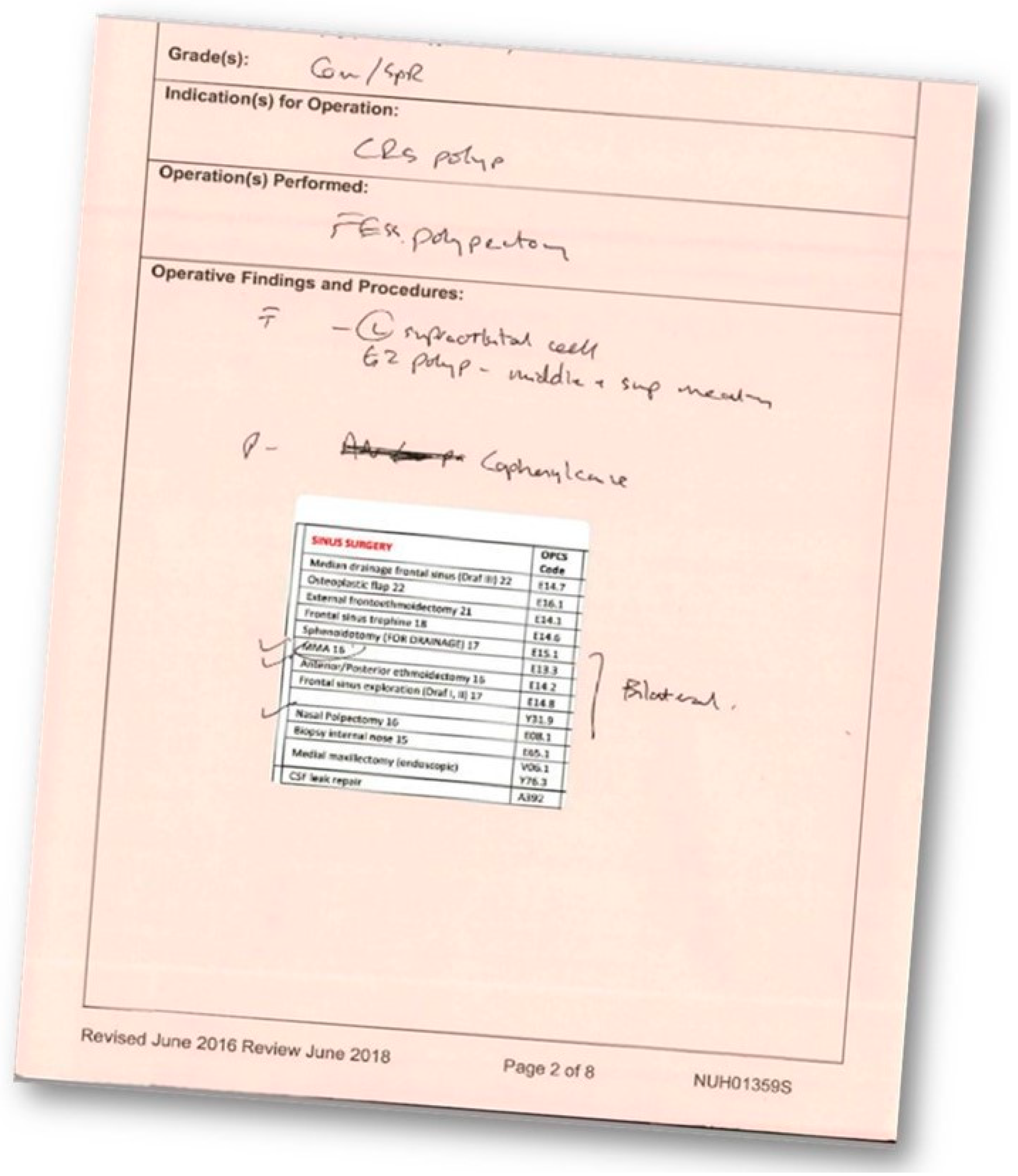 Sinusitis 05 00004 g001
