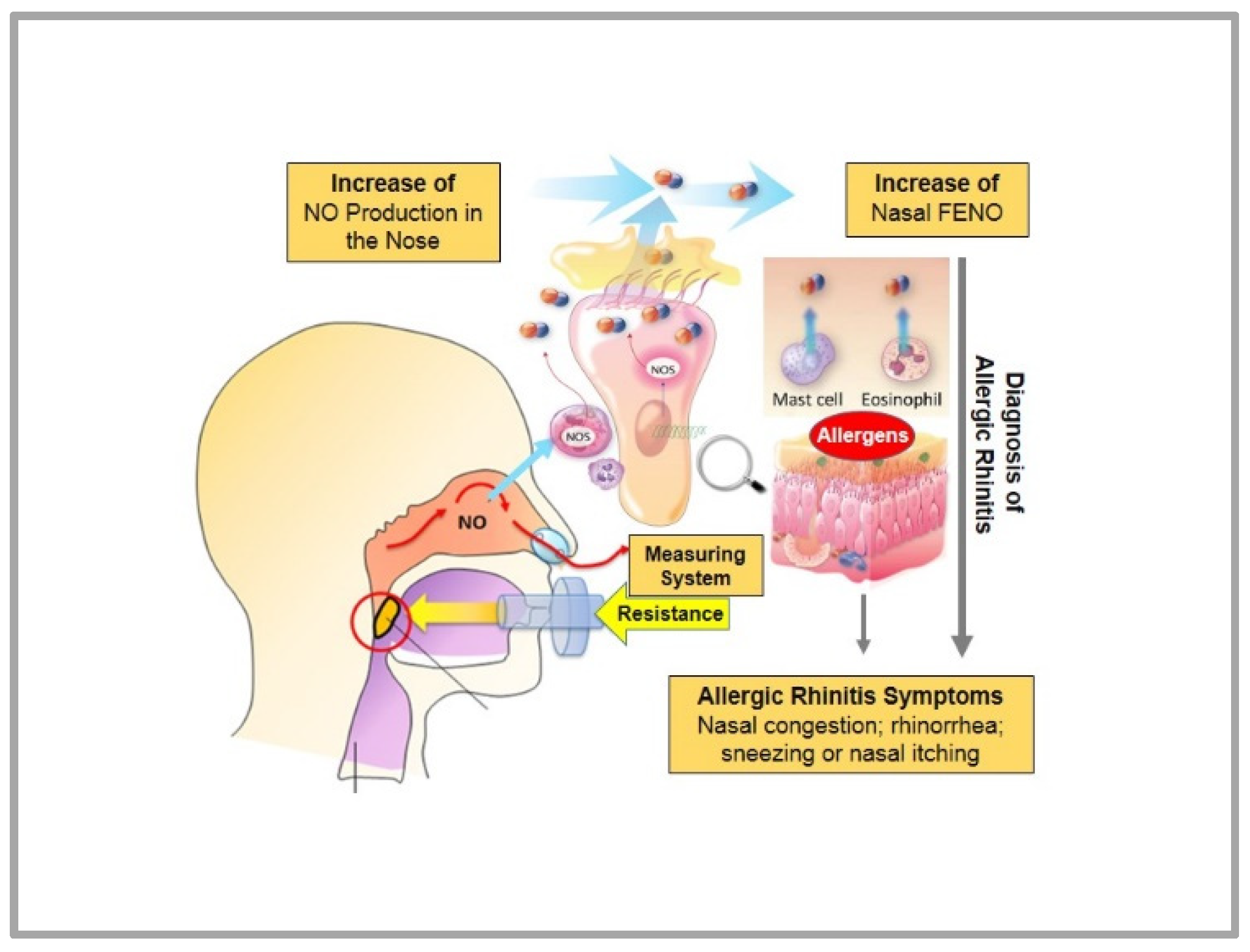 Sinusitis 05 00013 g003 550