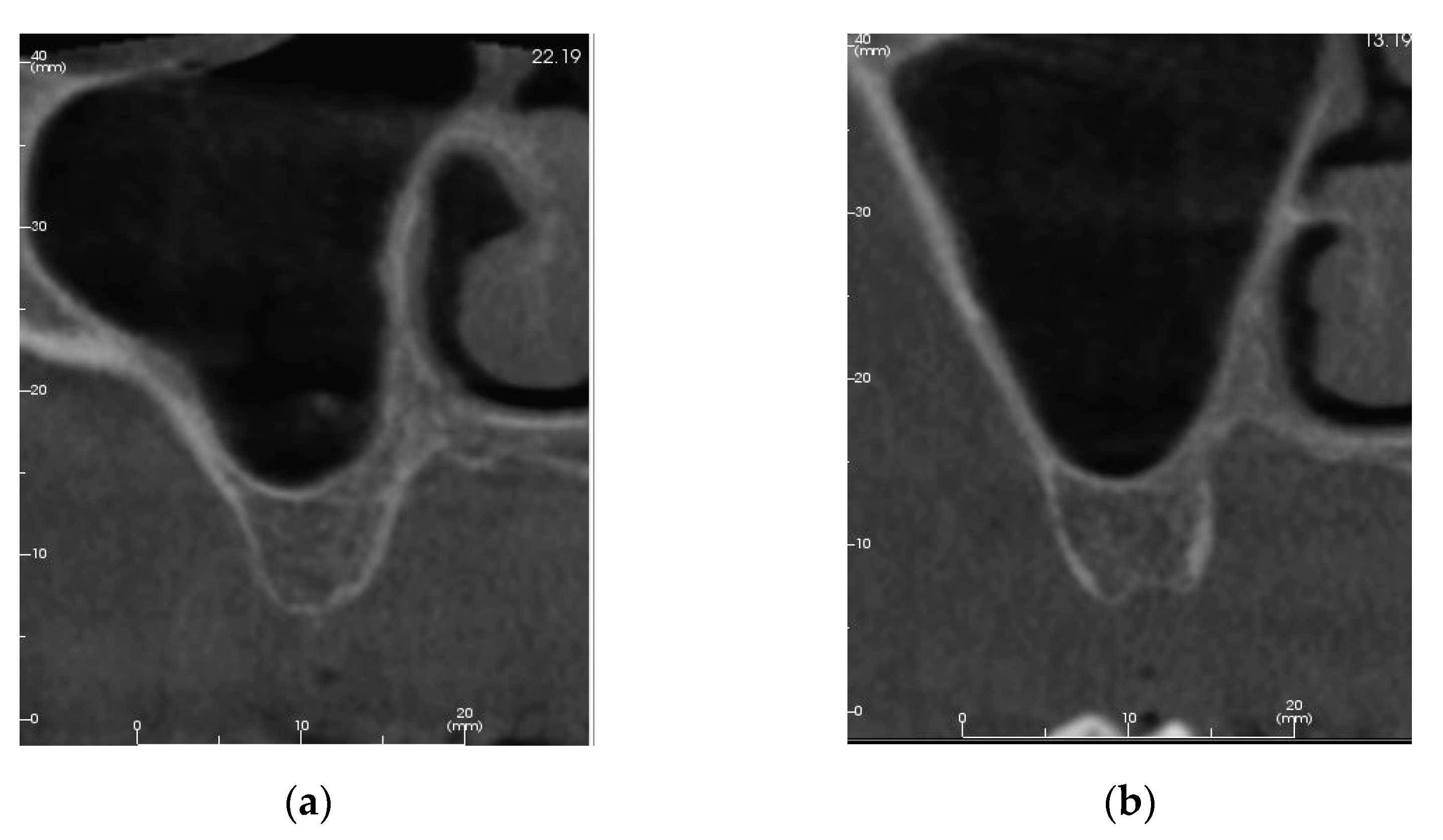 Sinusitis 05 00014 g001 Sinusitis 05 00014 g001
