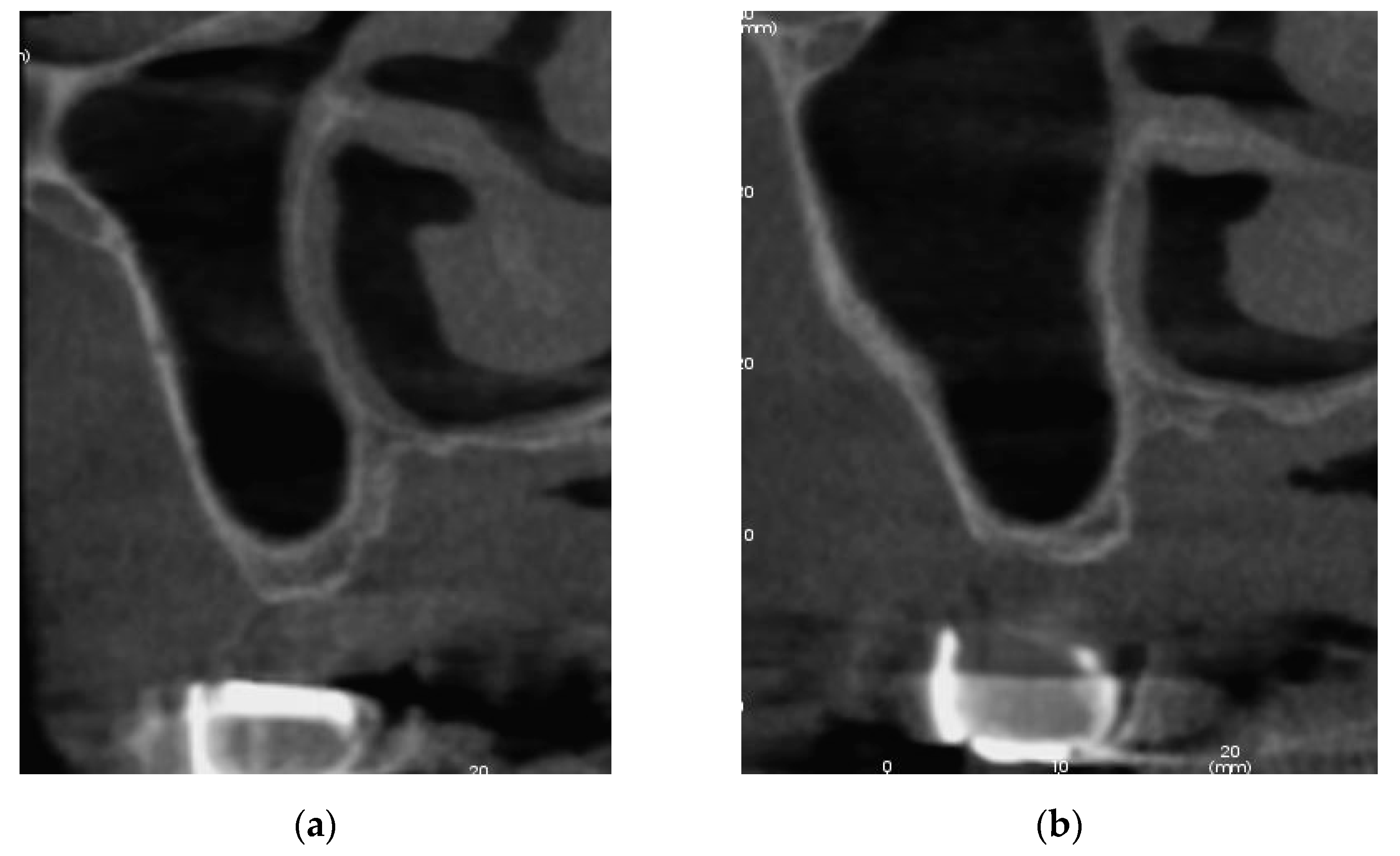 Sinusitis 05 00014 g002 Sinusitis 05 00014 g002