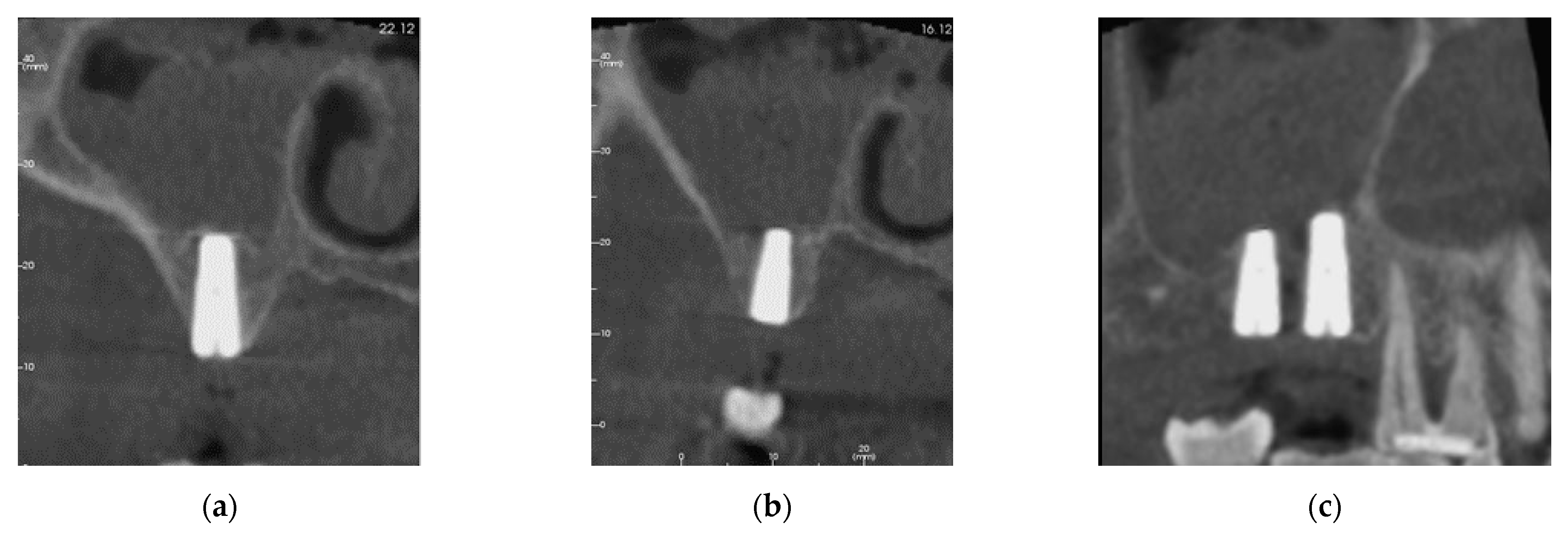 Sinusitis 05 00014 g004 Sinusitis 05 00014 g004