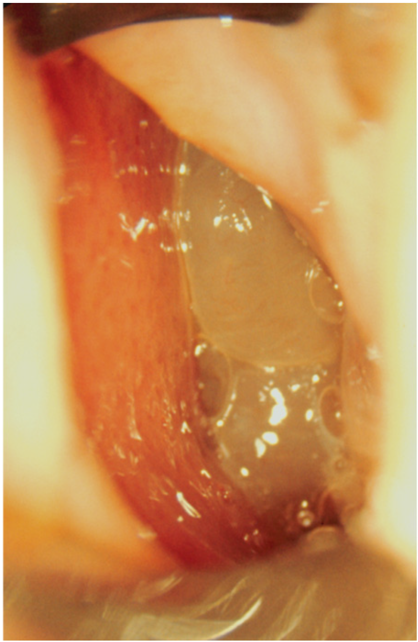 Sinusitis 08 00006 g001 Sinusitis 08 00006 g001