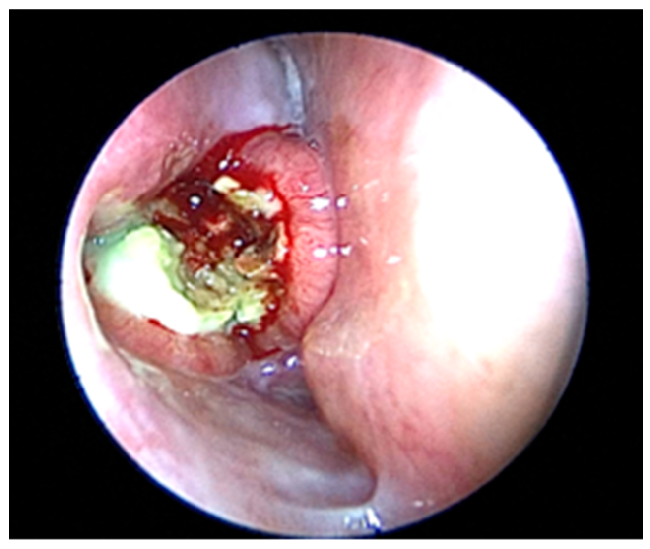 Sinusitis 09 00002 g002