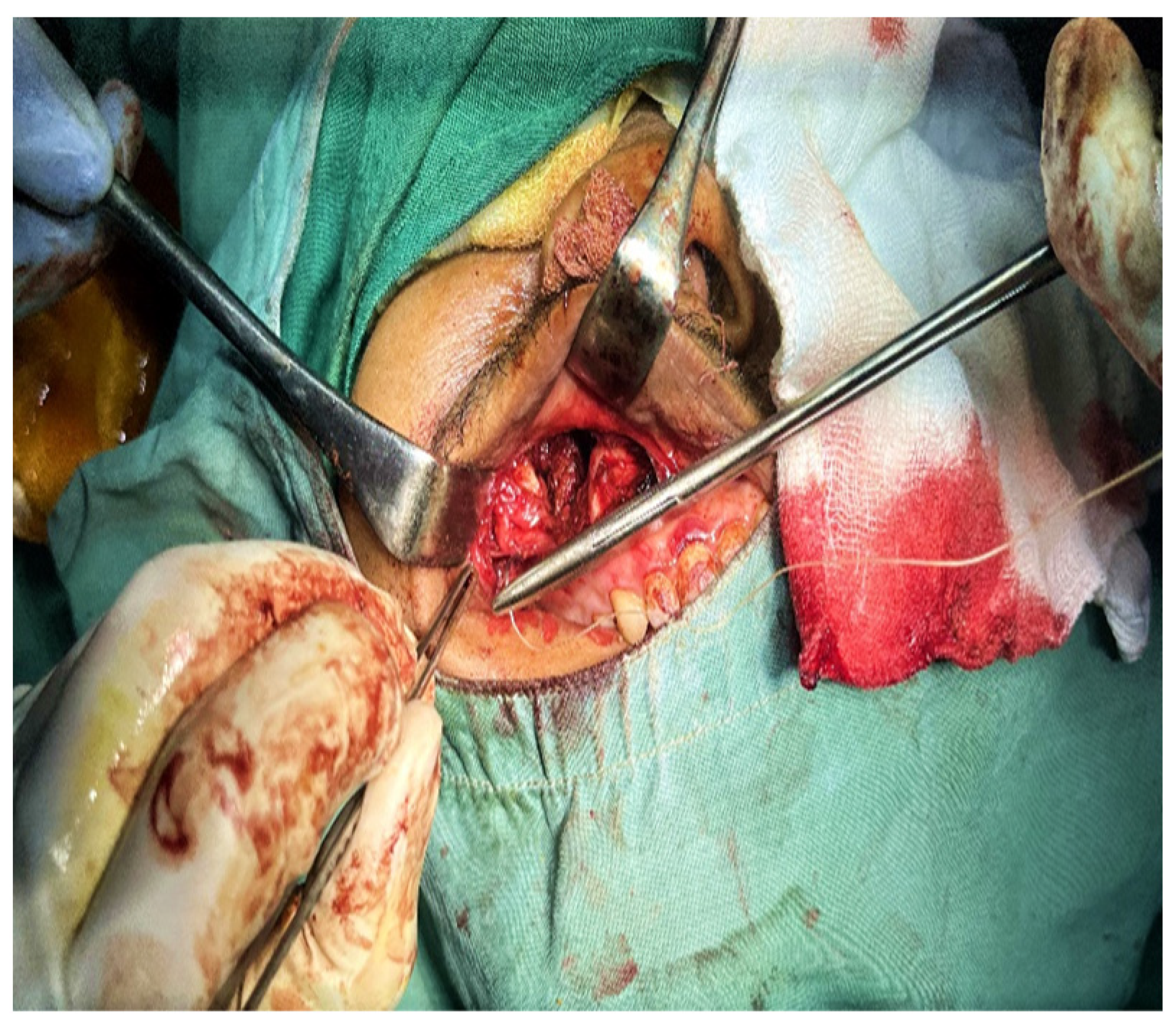 Sinusitis 09 00004 g002