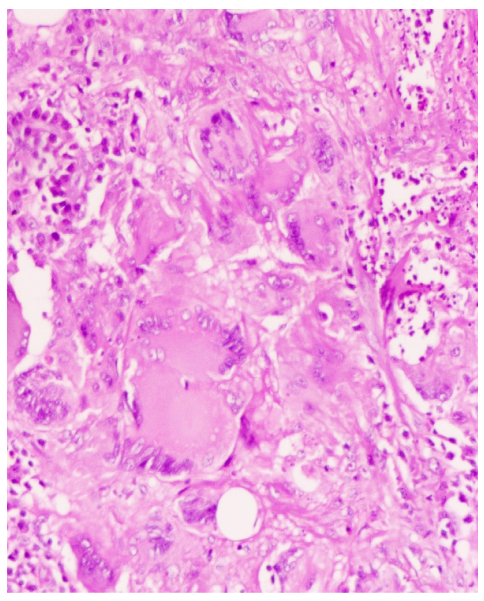Sinusitis 09 00004 g003