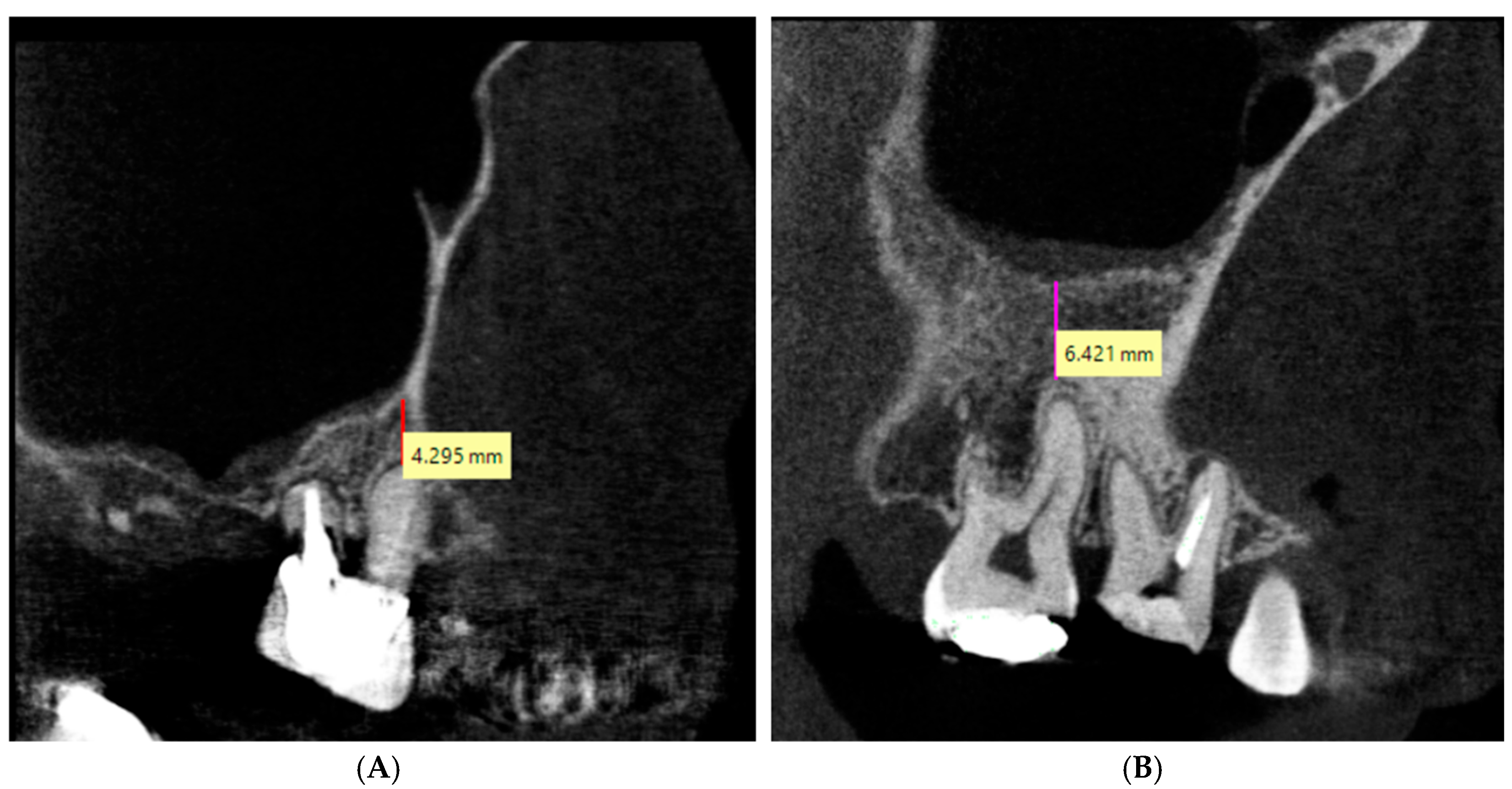 Sinusitis 09 00009 g002