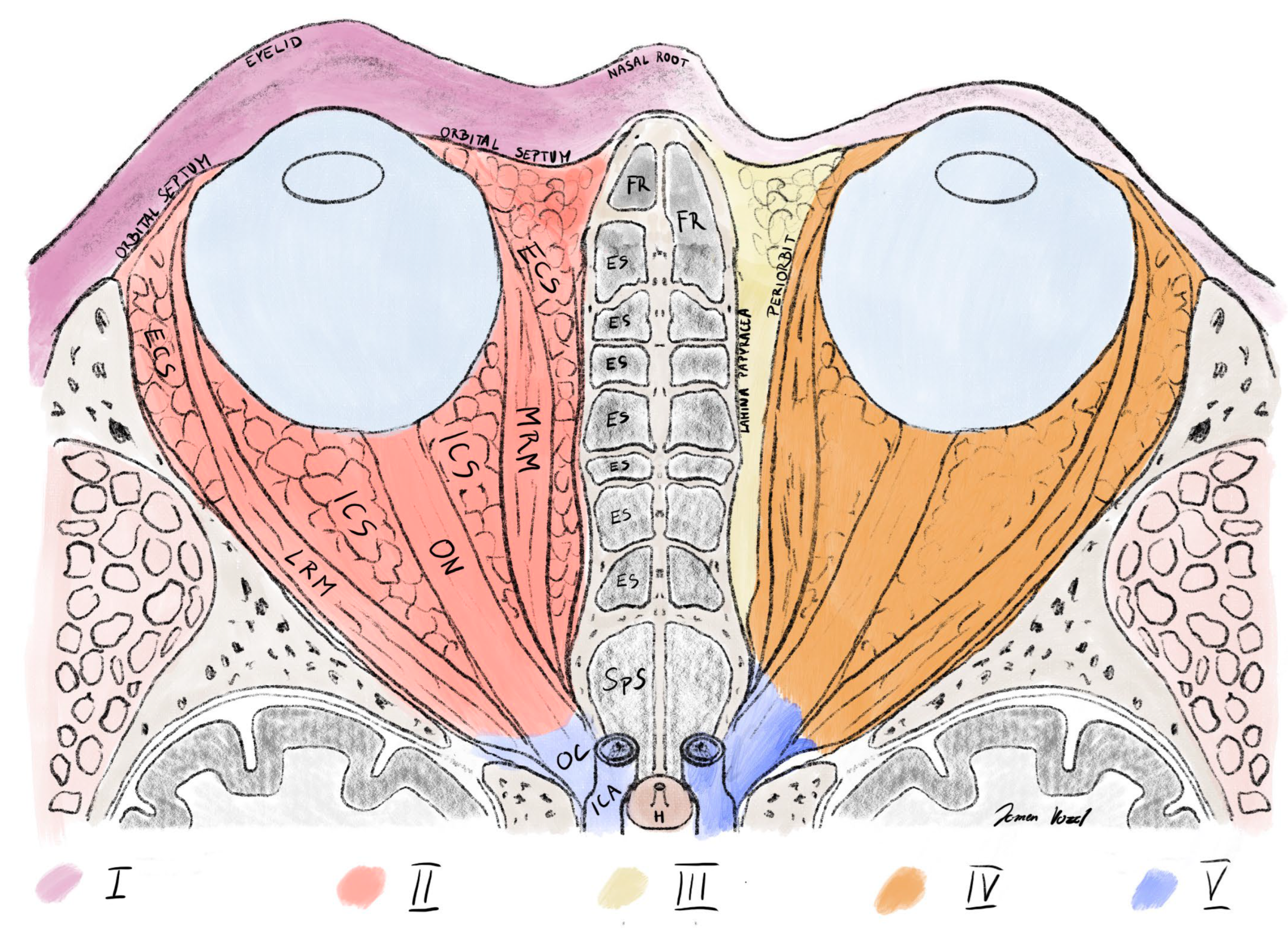 Sinusitis 09 00011 g004