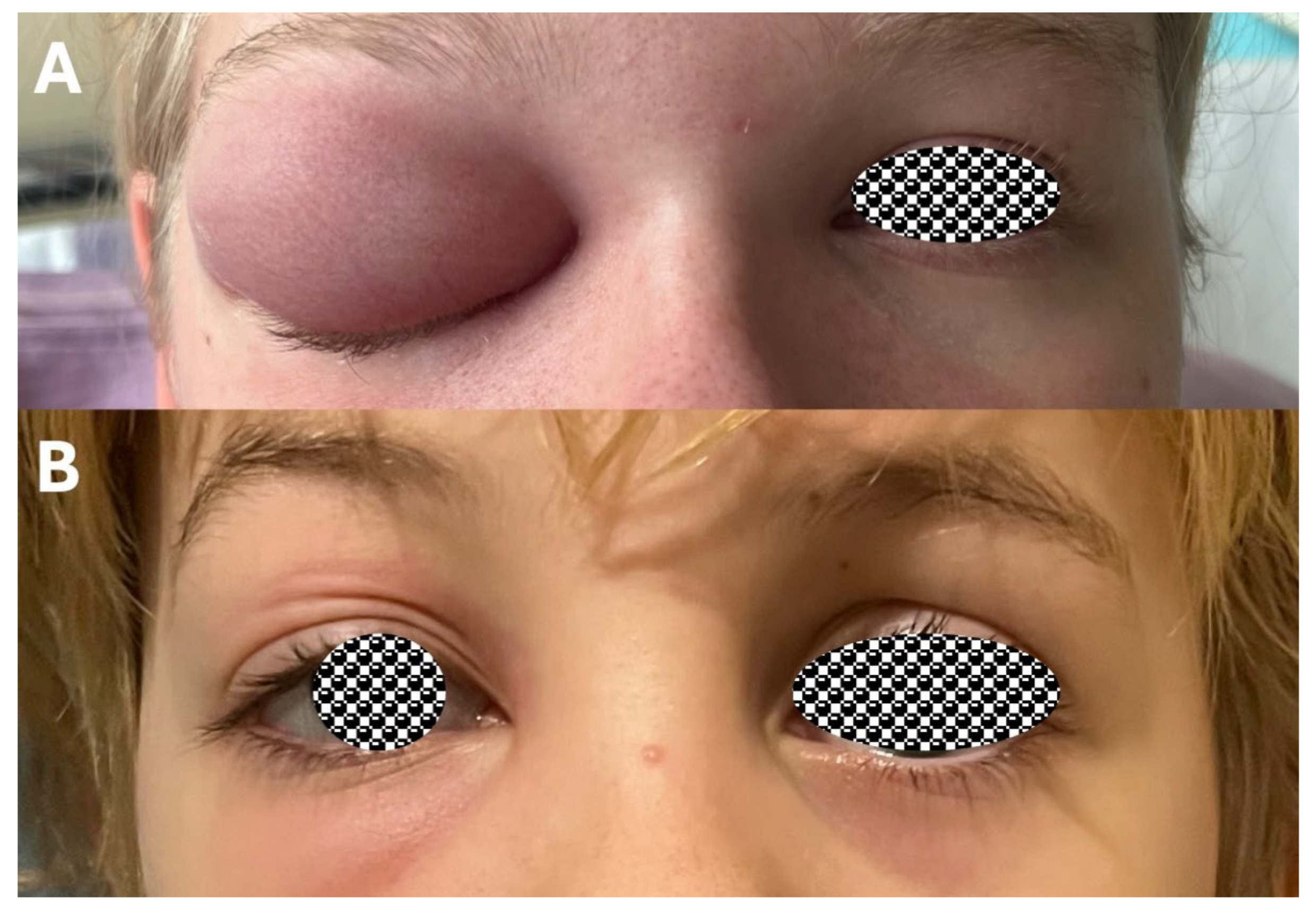 Sinusitis 09 00011 g005