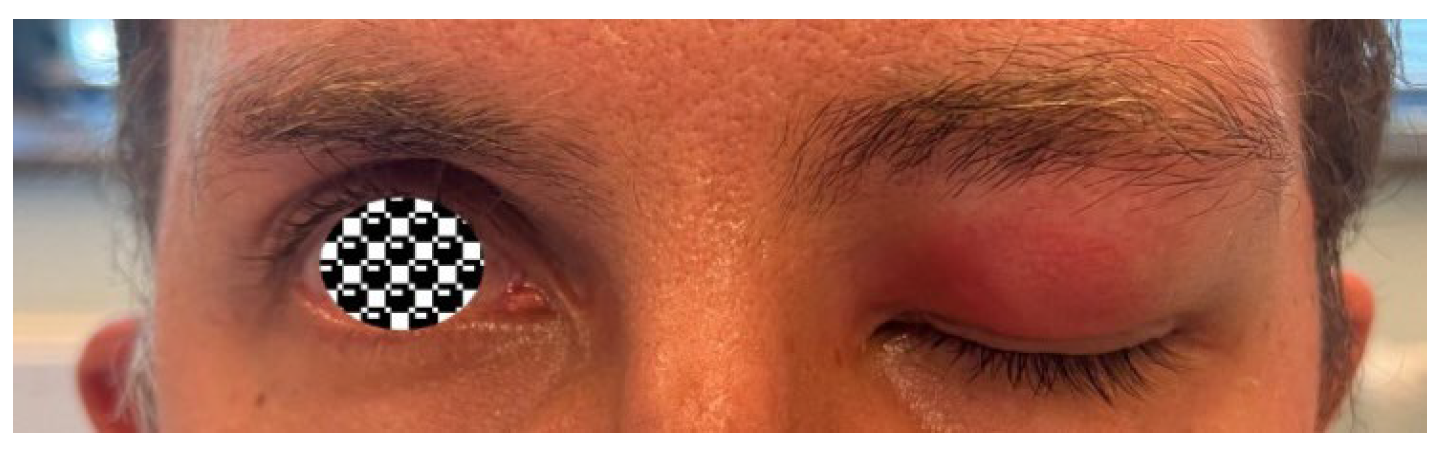 Sinusitis 09 00011 g007