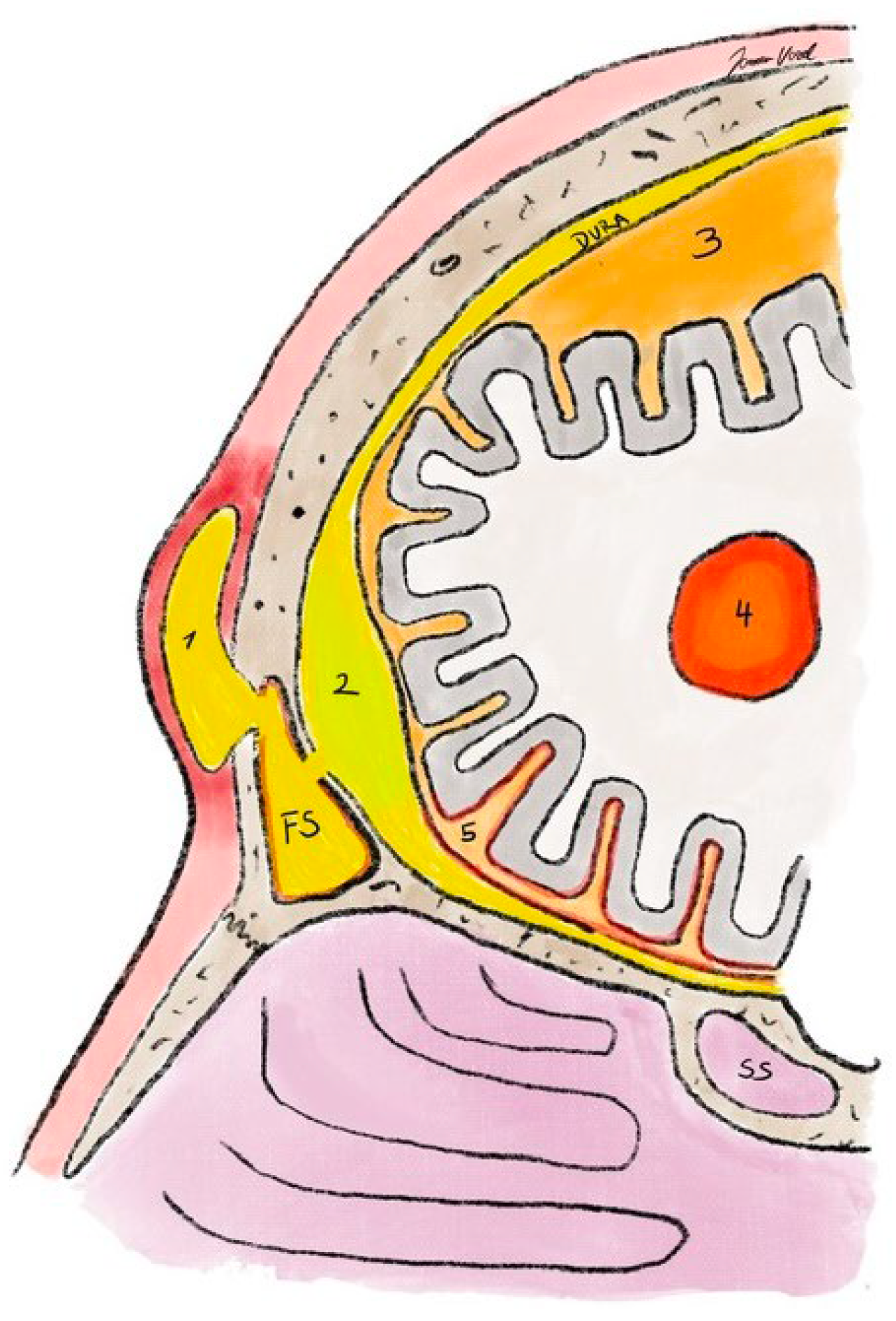 Sinusitis 09 00011 g010