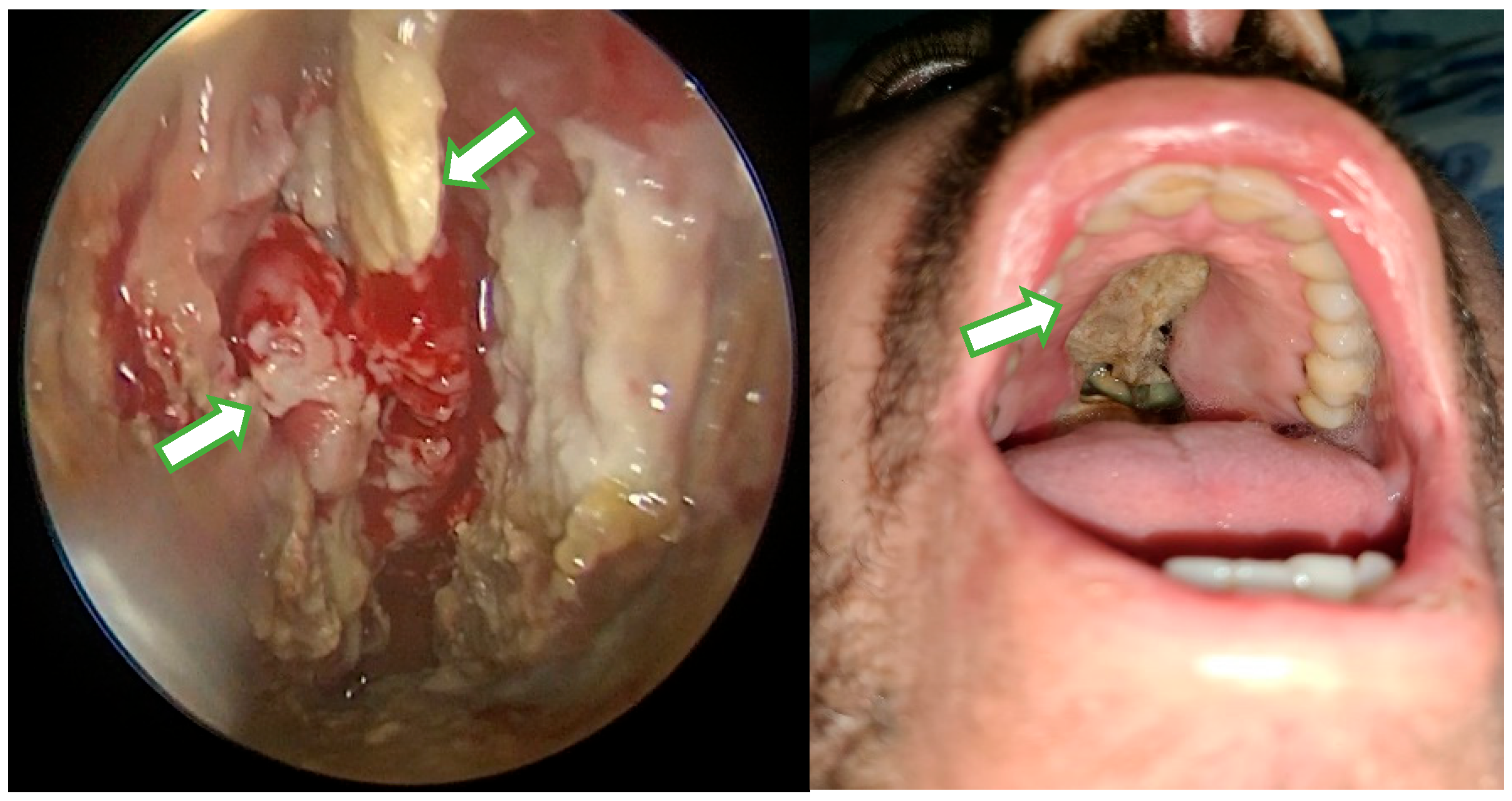 Sinusitis 09 00012 g002