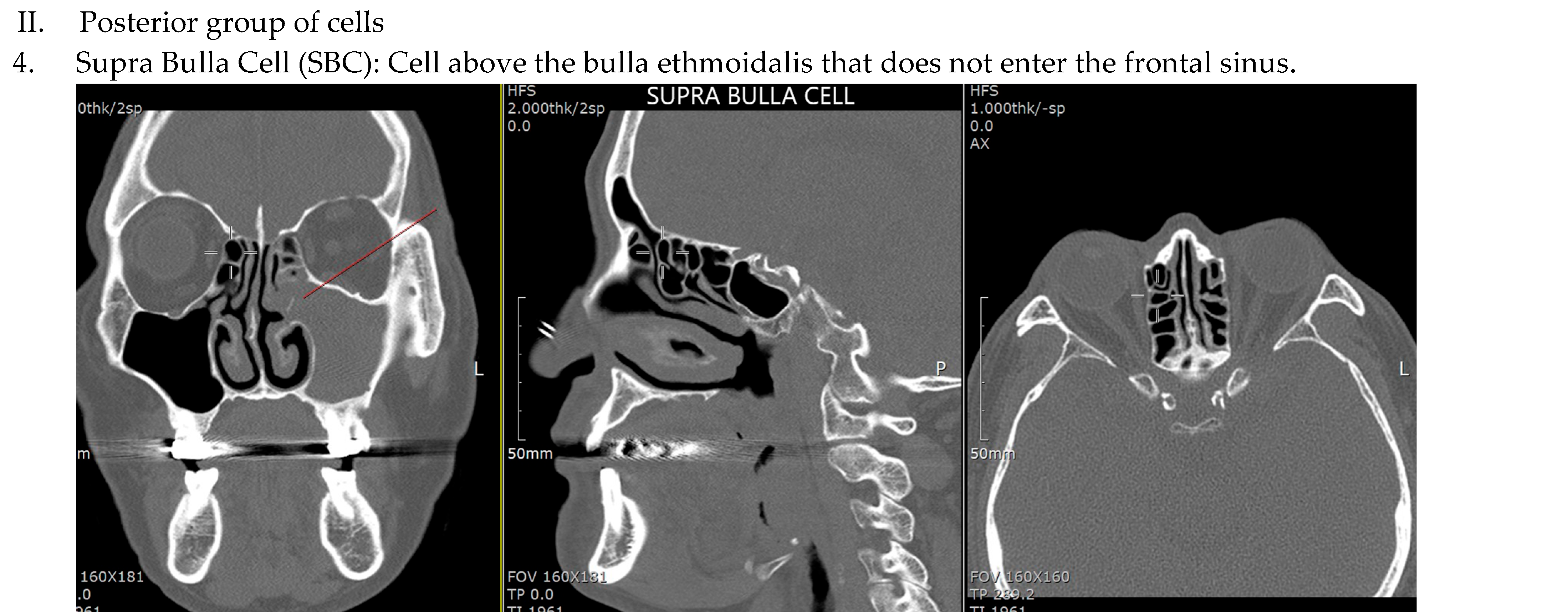 Sinusitis 09 00014 g001c