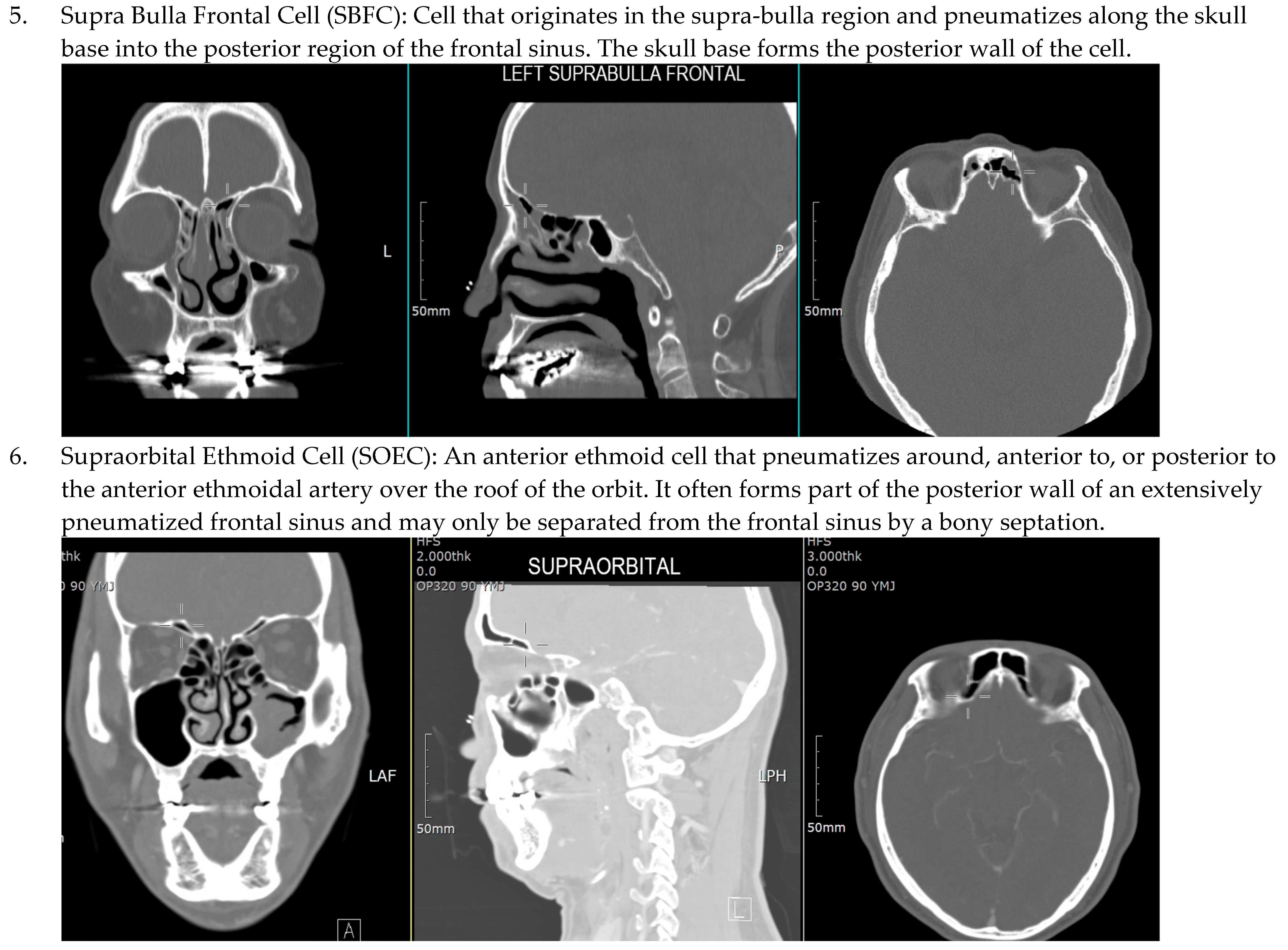 Sinusitis 09 00014 g001d