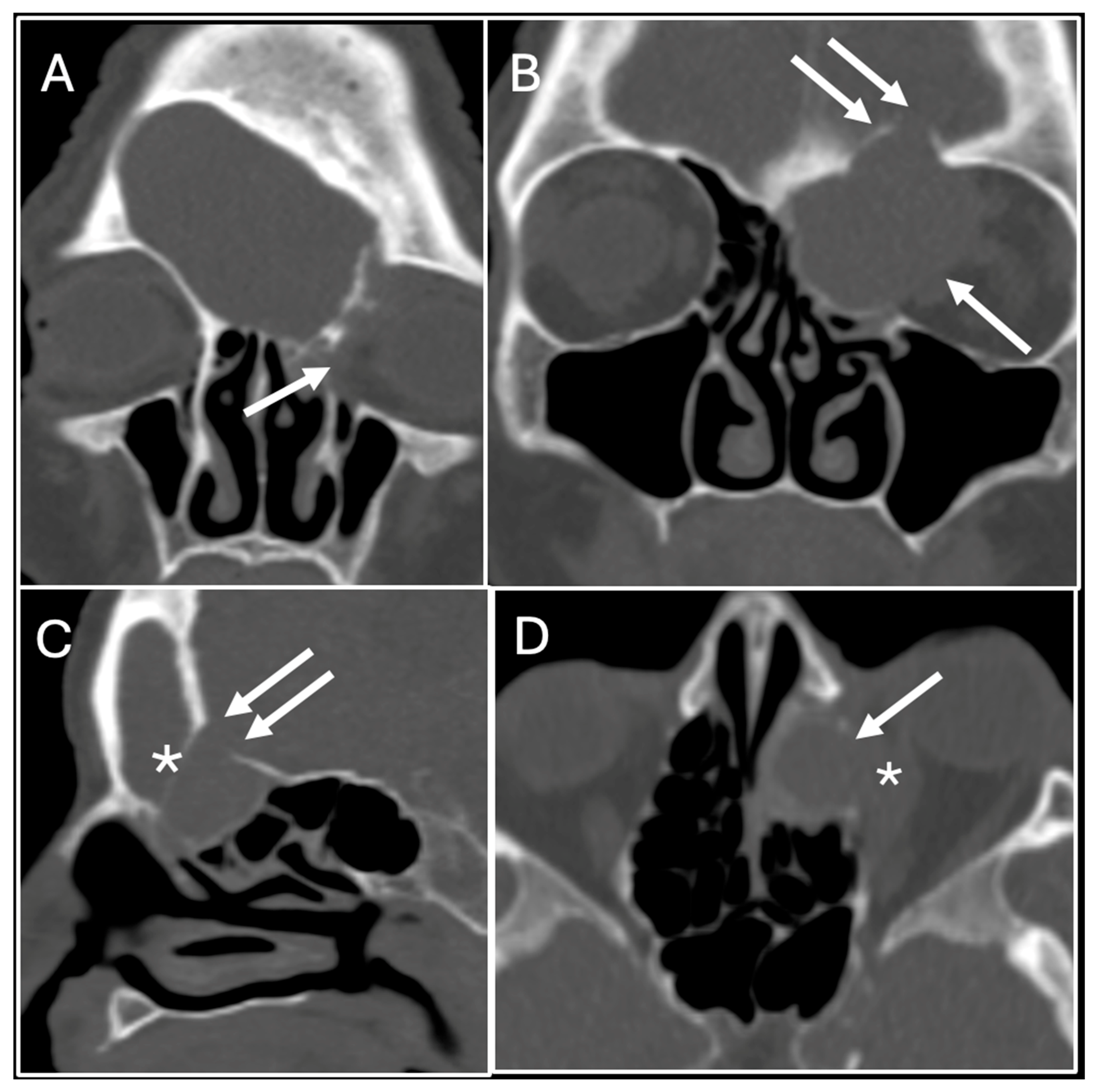 Sinusitis 09 00015 g001