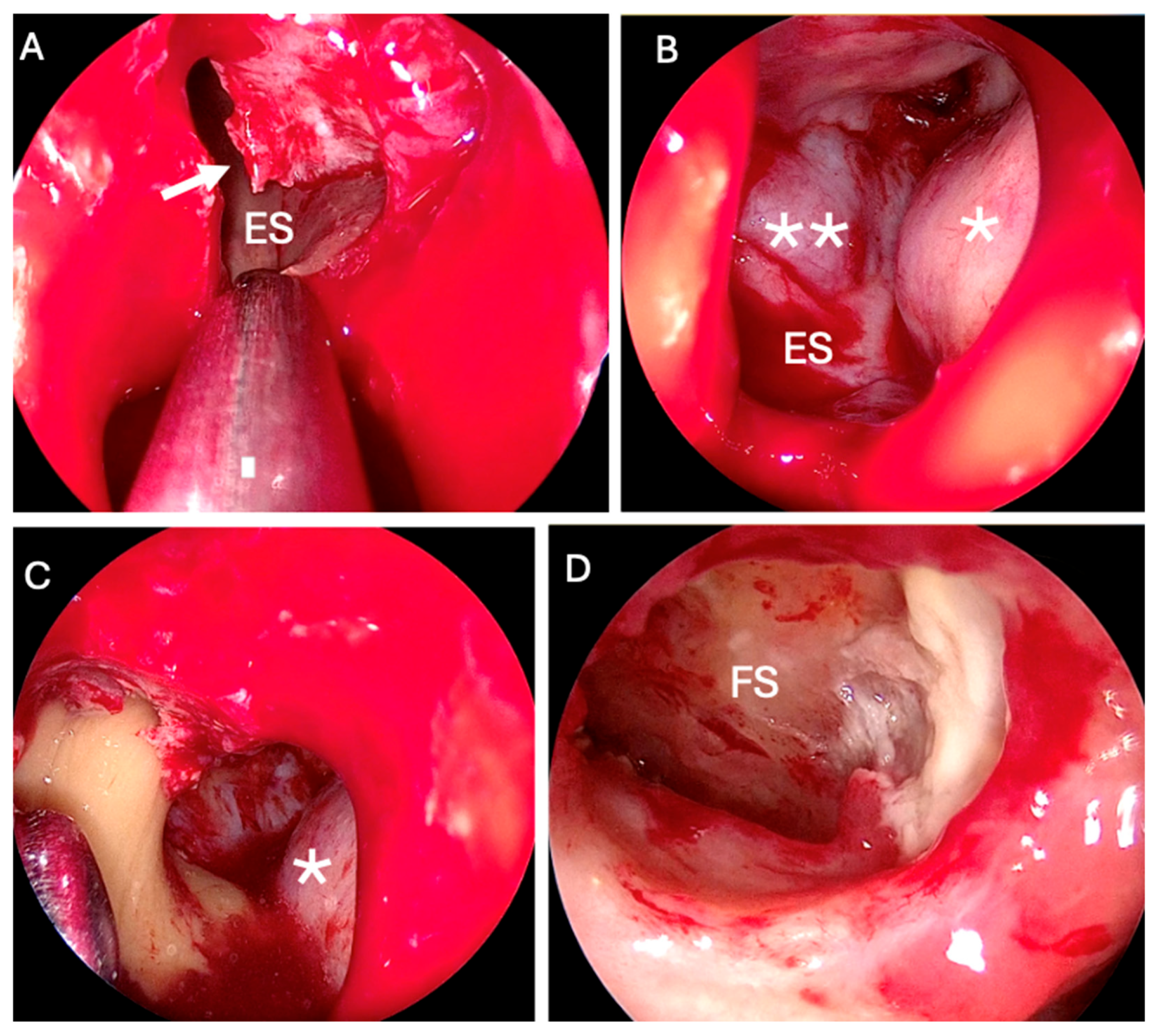 Sinusitis 09 00015 g003