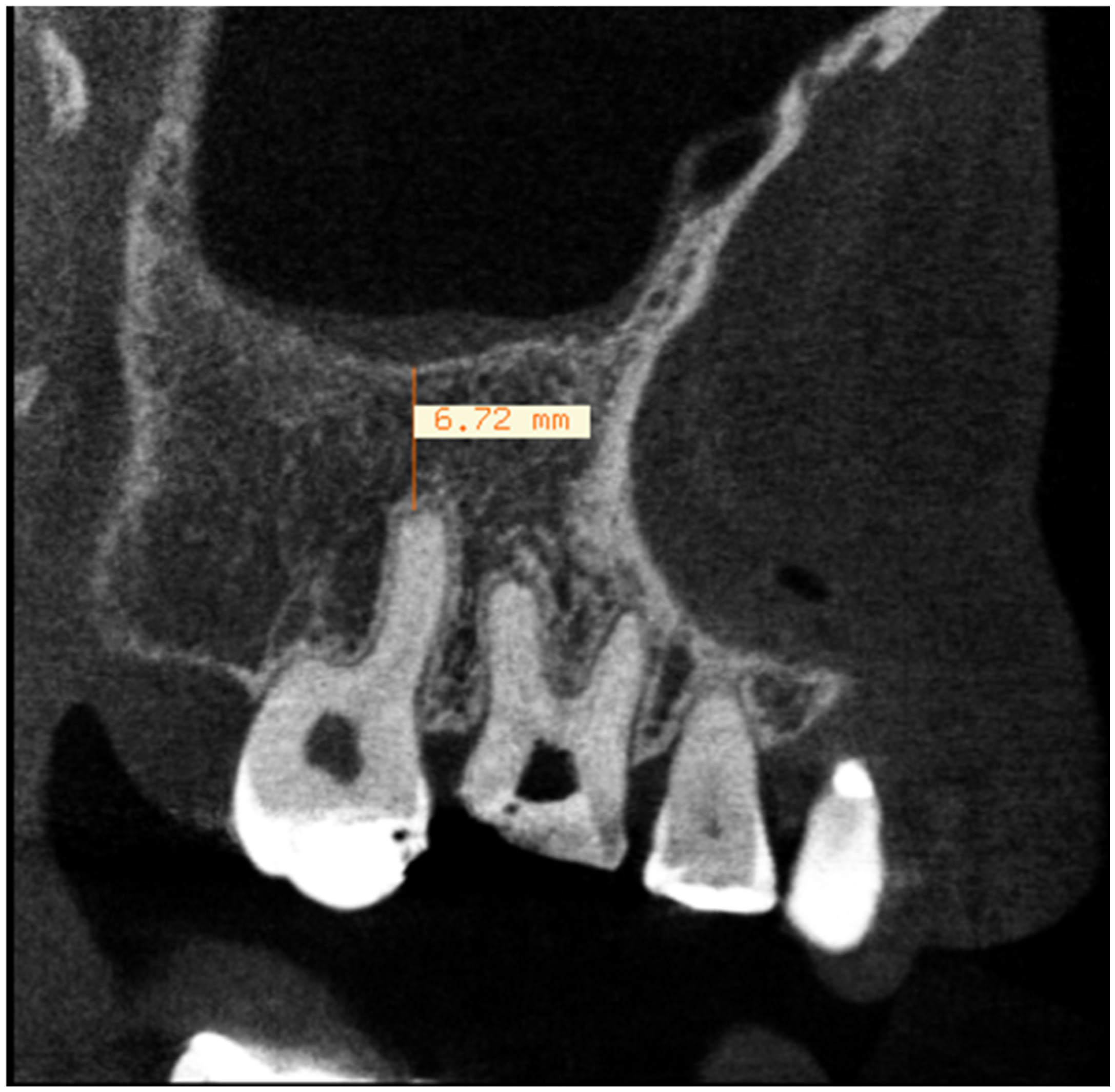 Sinusitis 09 00016 g001