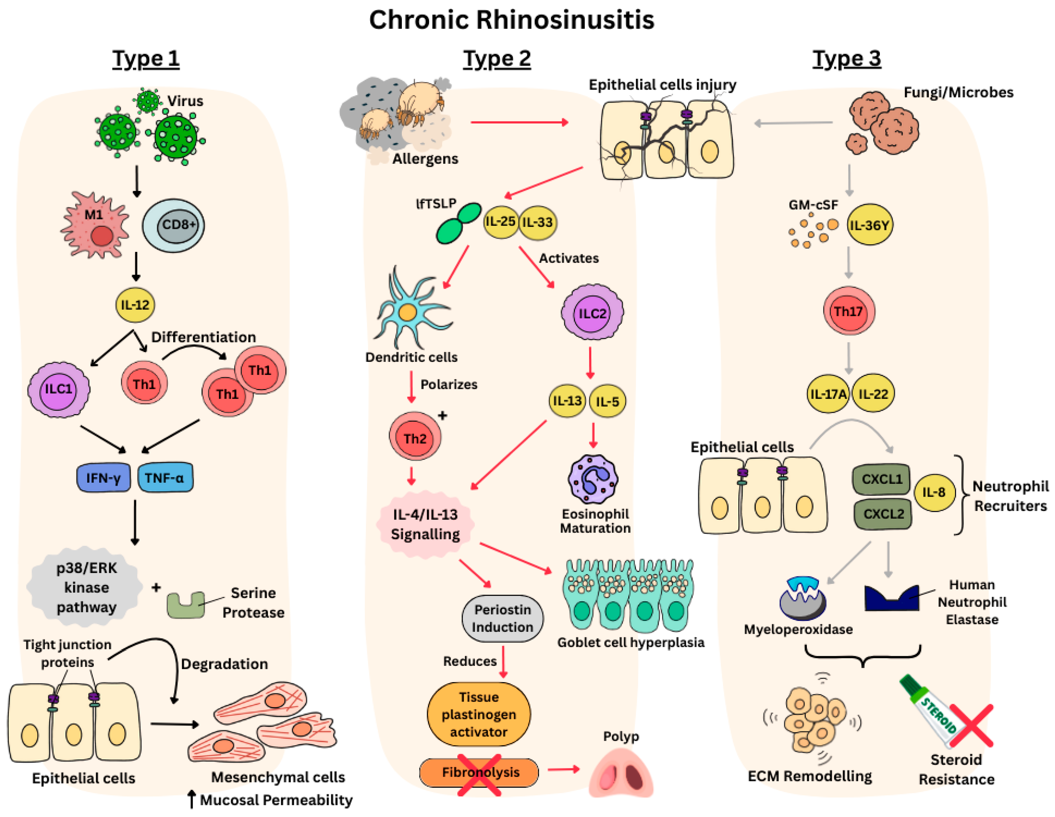 Sinusitis 09 00019 g001