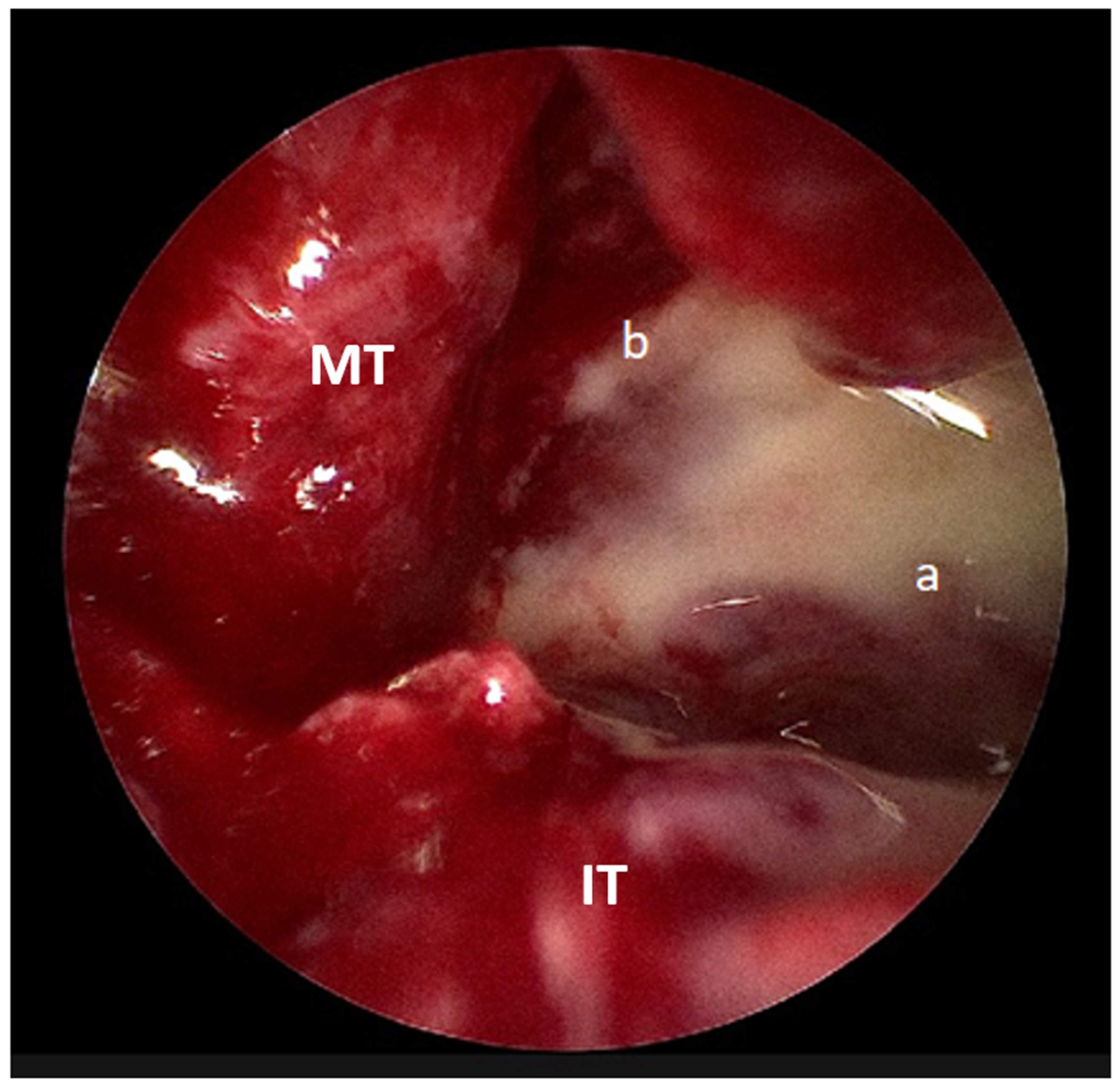 Sinusitis 09 00021 g004 Sinusitis 09 00021 g004